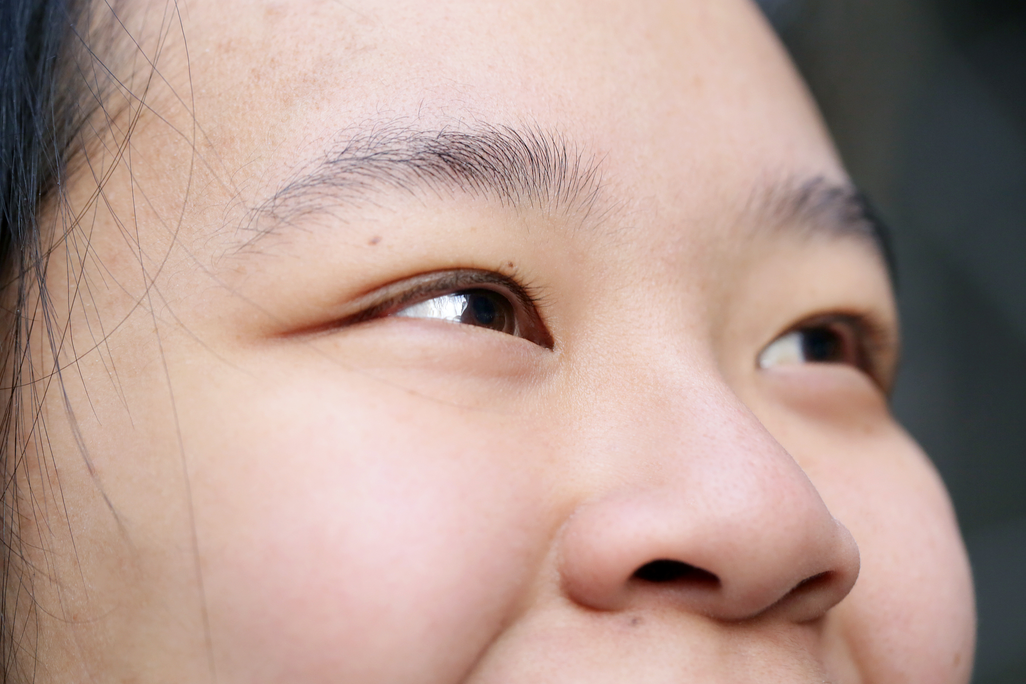 双眼皮修复朋友圈爆款文案不少于40字