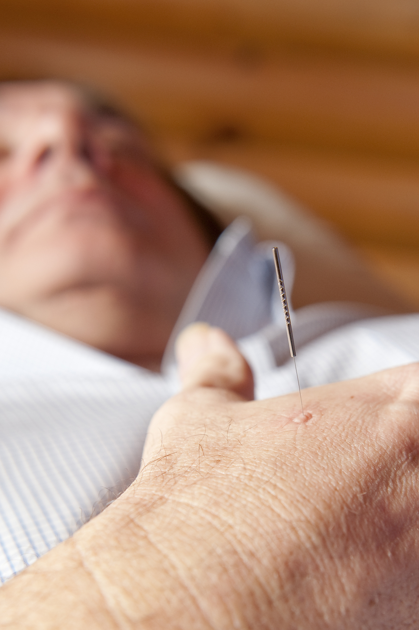 close up of acupuncture needle in man's hand