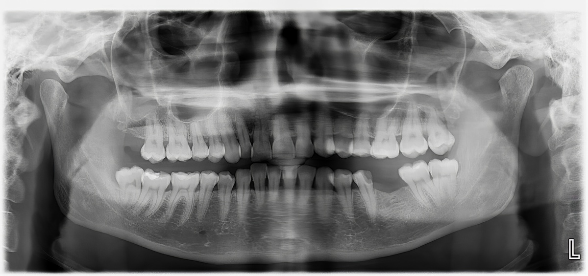 牙齿矫正可以做核磁吗为主题写一篇相关的文章和写一个相关标题