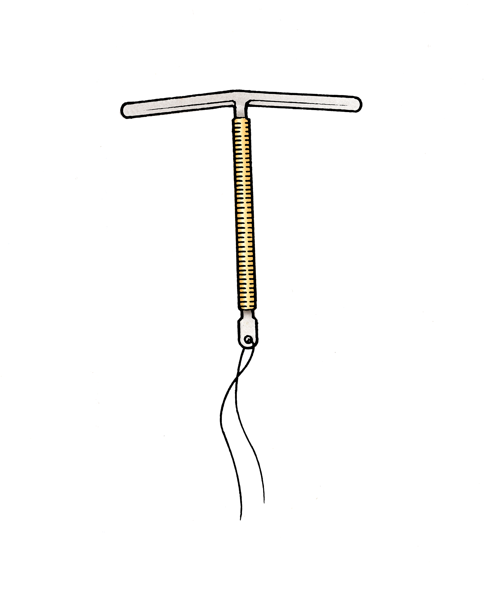 戴曼月乐环:避孕原理、优点、副作用及注意事项 戴曼月乐环:避孕原理、优点、副作用及注意事项