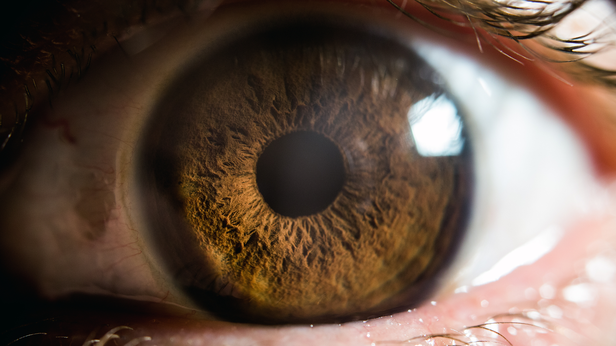 eye macro
