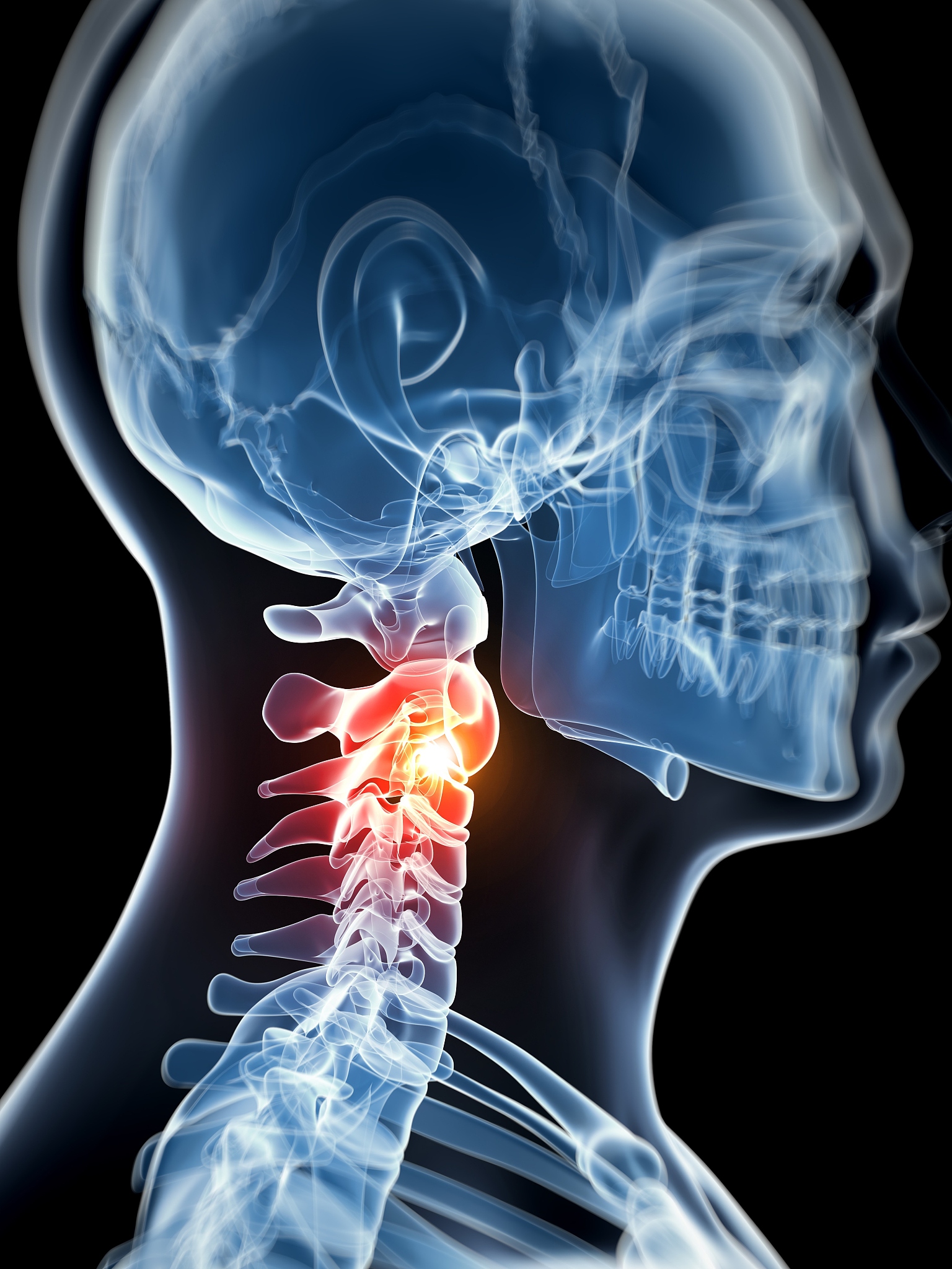 颈椎退行性病变头疼如何治疗最好？