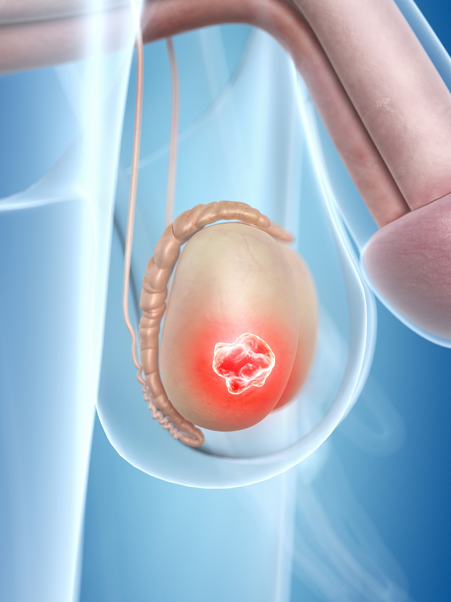 我需要你作为一名SEO帮助我把对应的关键词变为包含多个需求且吸引人的SEO长标题但要注意长标题不可以是疑问句以下是内容：输卵管阻塞试管成功案例