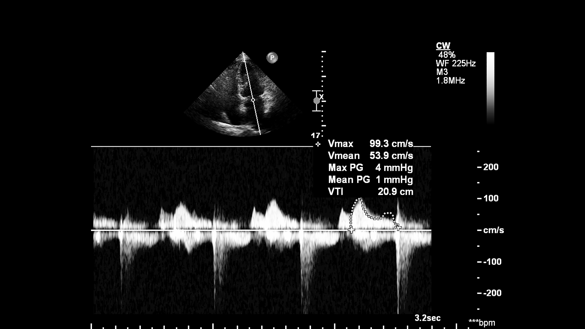 与长波极限法有关的论文和书籍