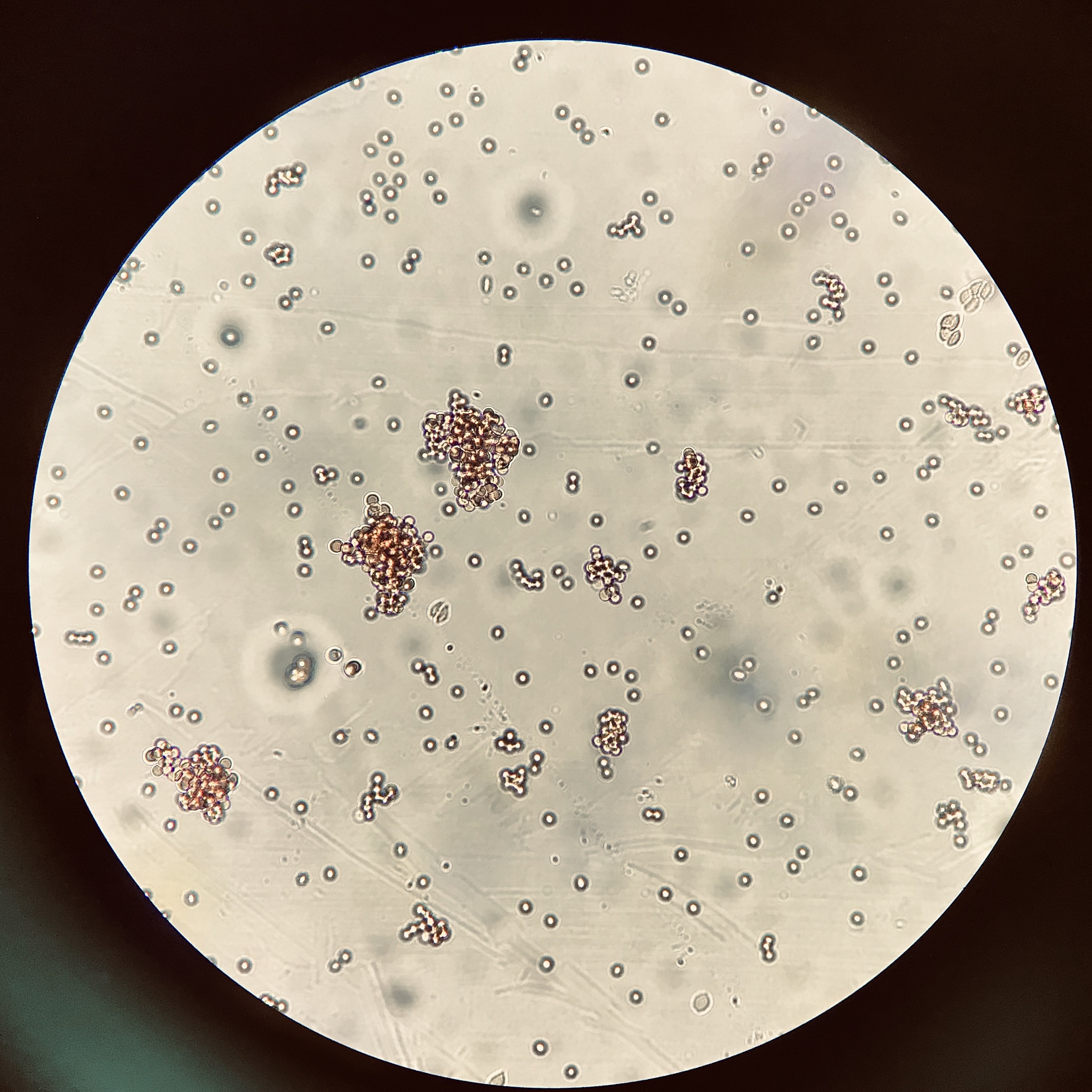 金黄色葡萄球菌诱导巨噬细胞分泌IL-6的机制研究
