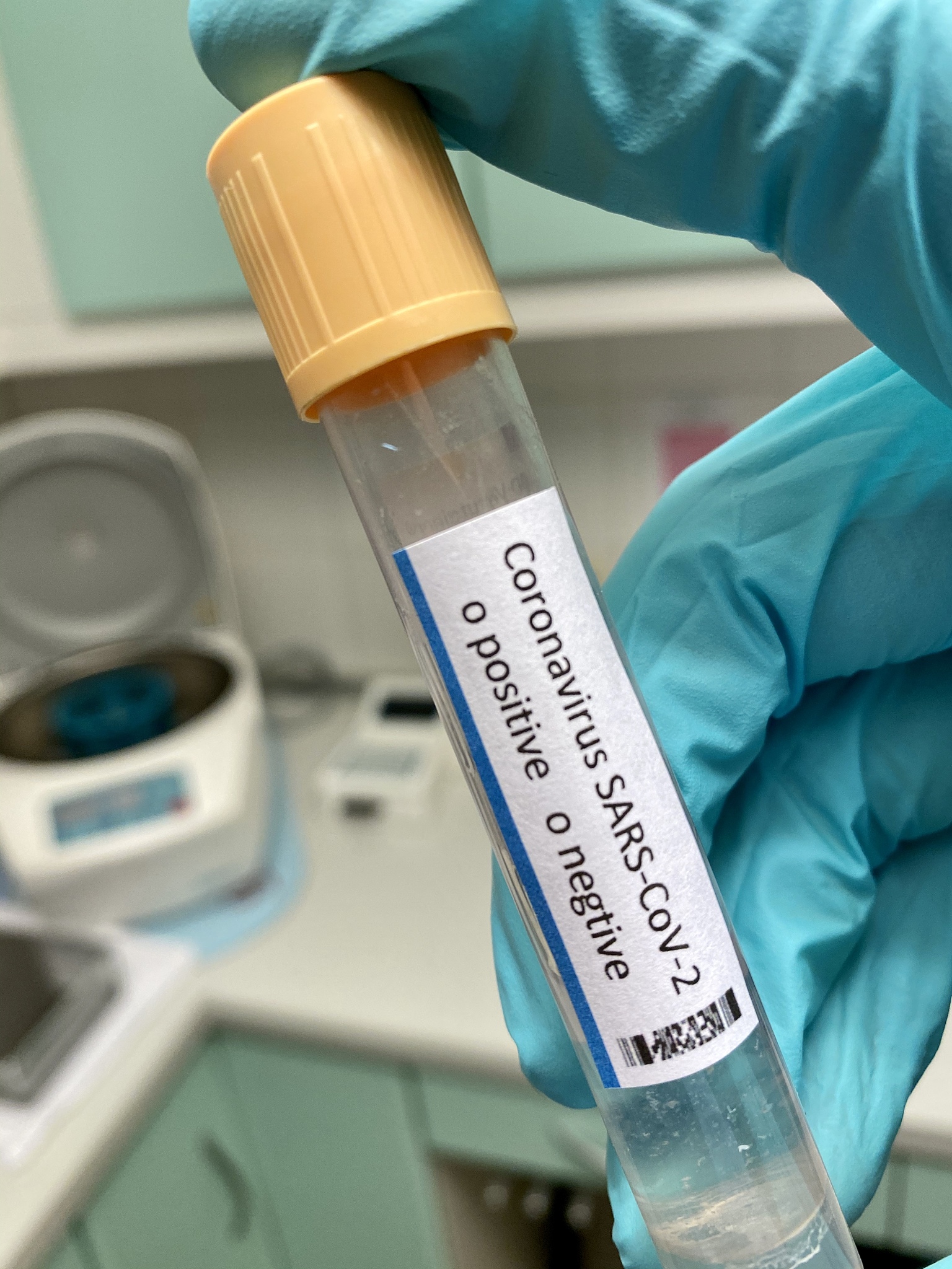 阳泉职业技术学院医学检验技术专业课程设置详解