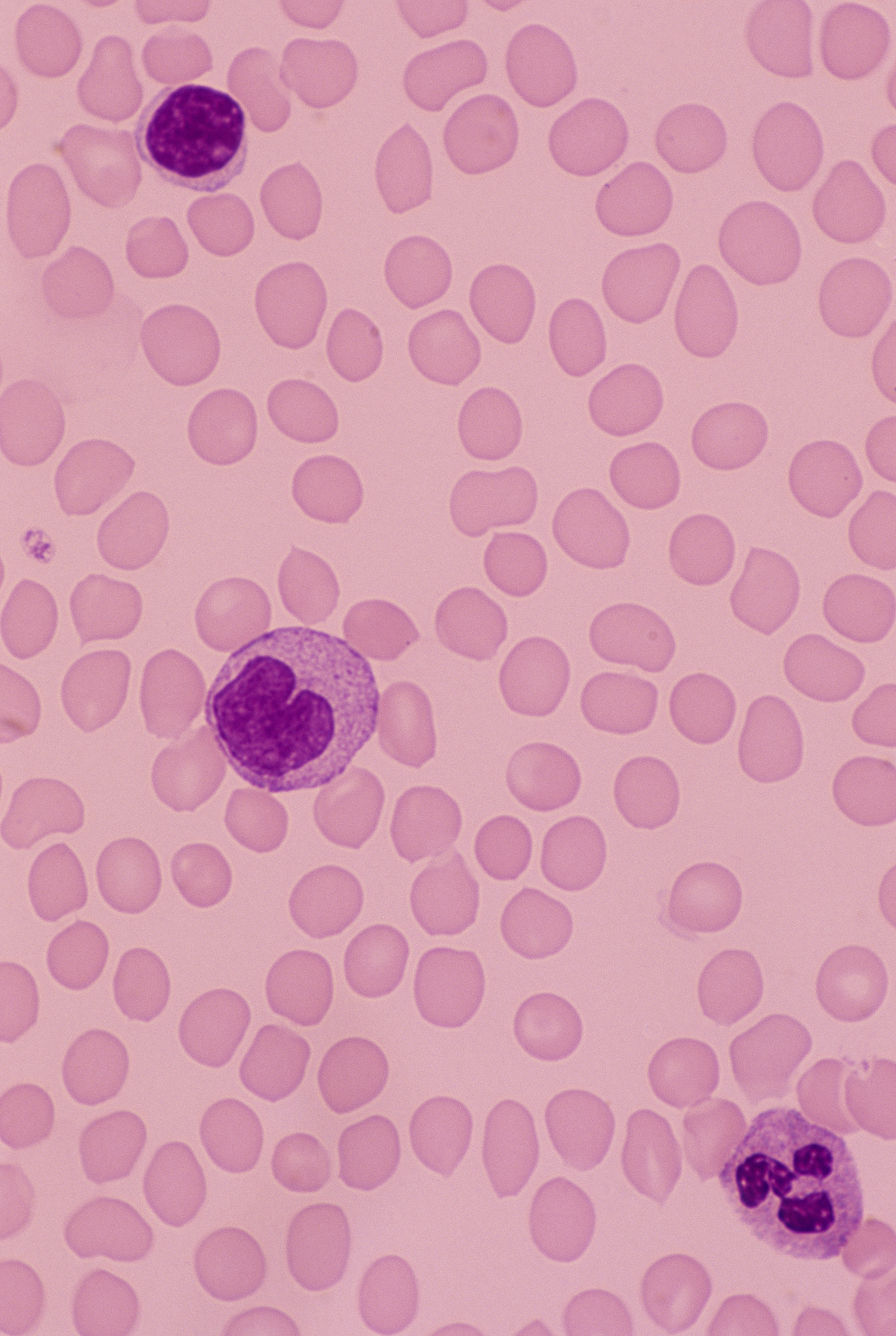 白细胞指标范围：正常值、影响因素及解读