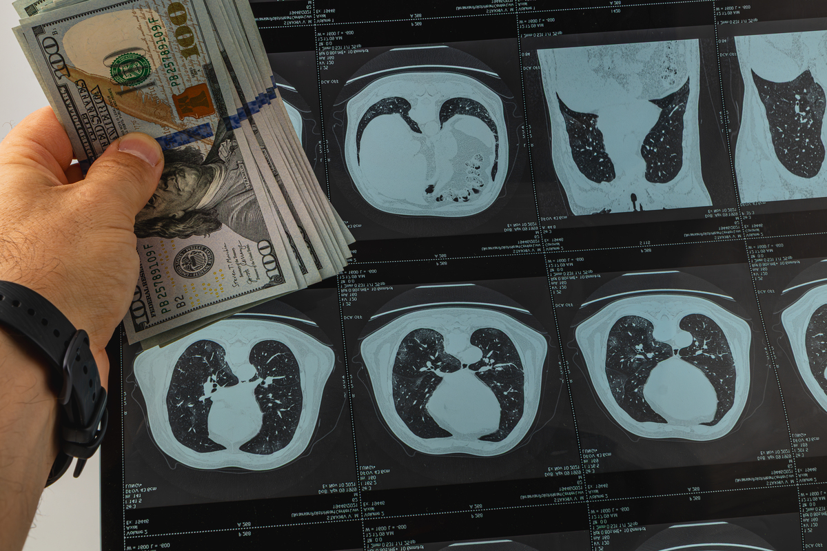 详细介绍一下医学图像分割的这几个概念：TPFPFNTN