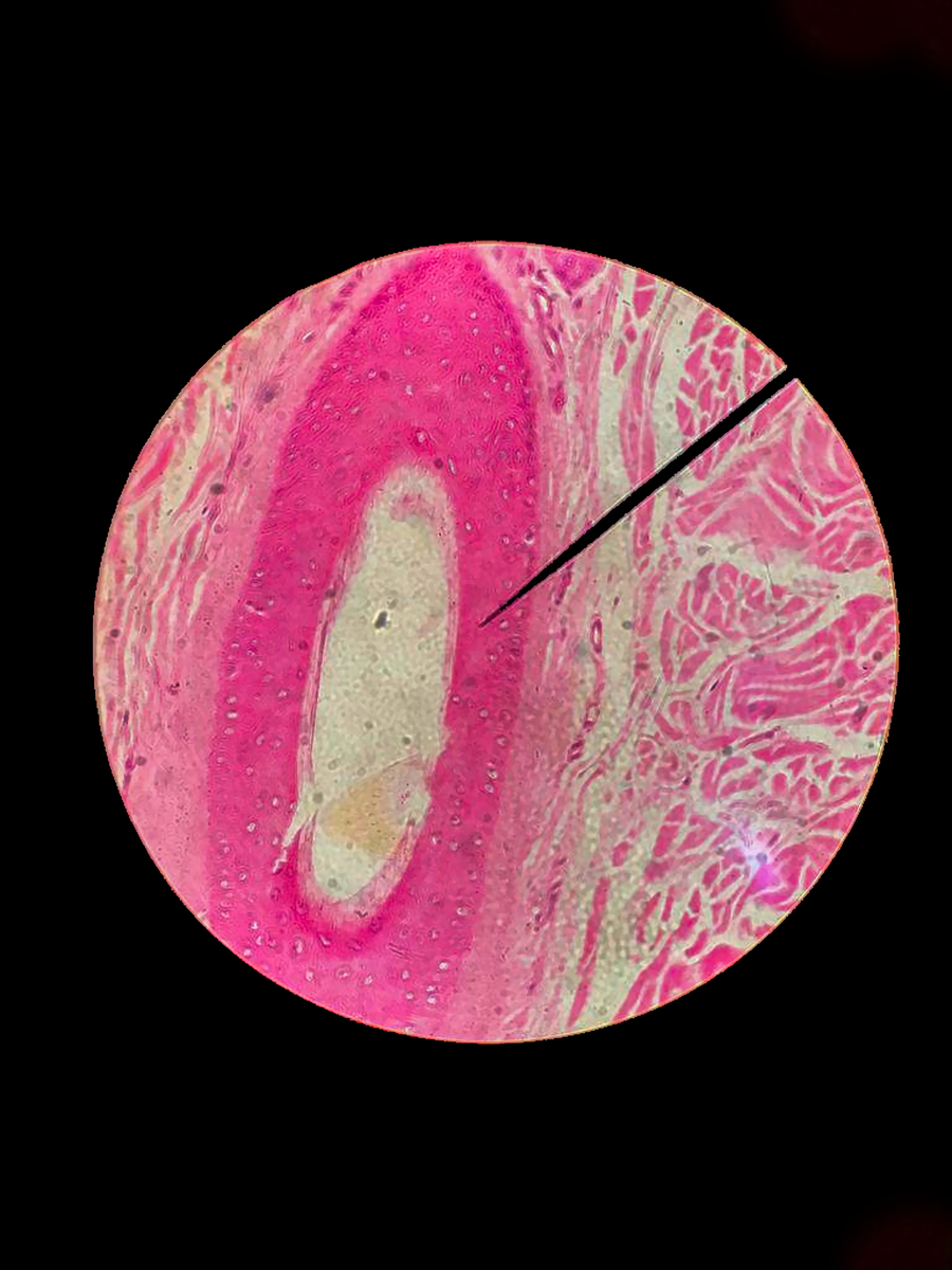 含味蕾的舌乳头