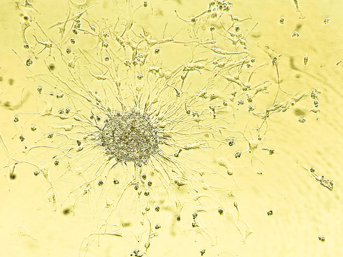 下列细胞中没有吞噬功能是 A、淋巴细胞 B、单核细胞 C、小胶质细胞 D、胸腺上皮细胞