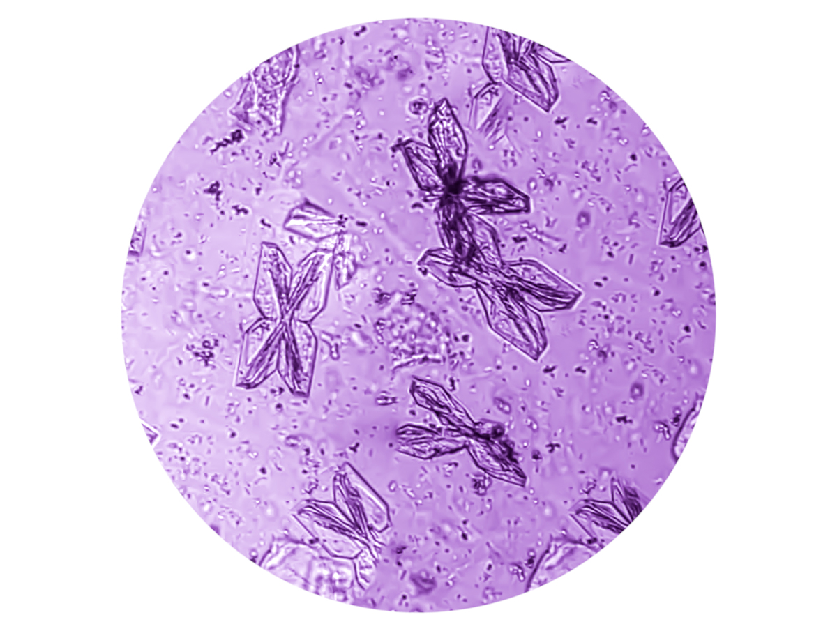 Tonsil Crypt Epithelial Cells: Definition and Importance
