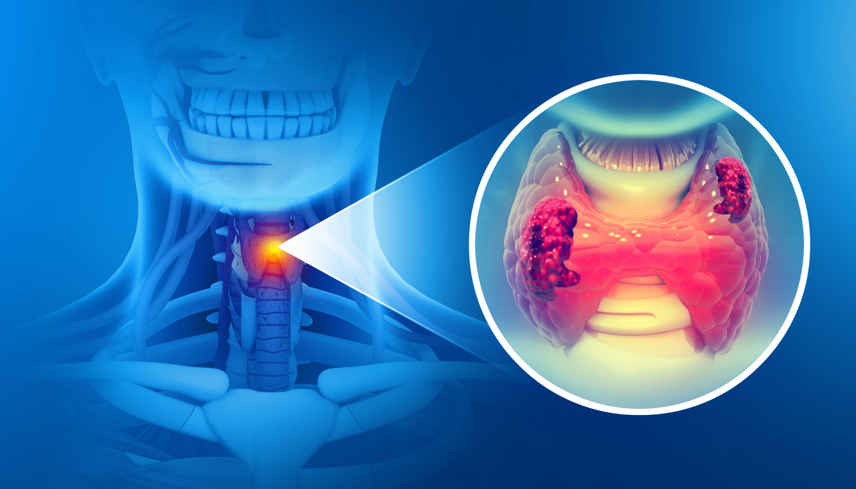 甲状腺射频消融手术在中国大陆哪里做的最好