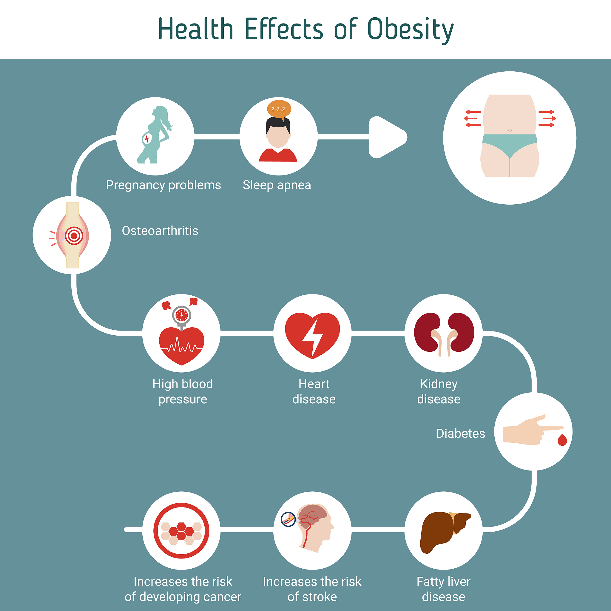 高胆固醇怎么办？日常6个方法控制胆固醇