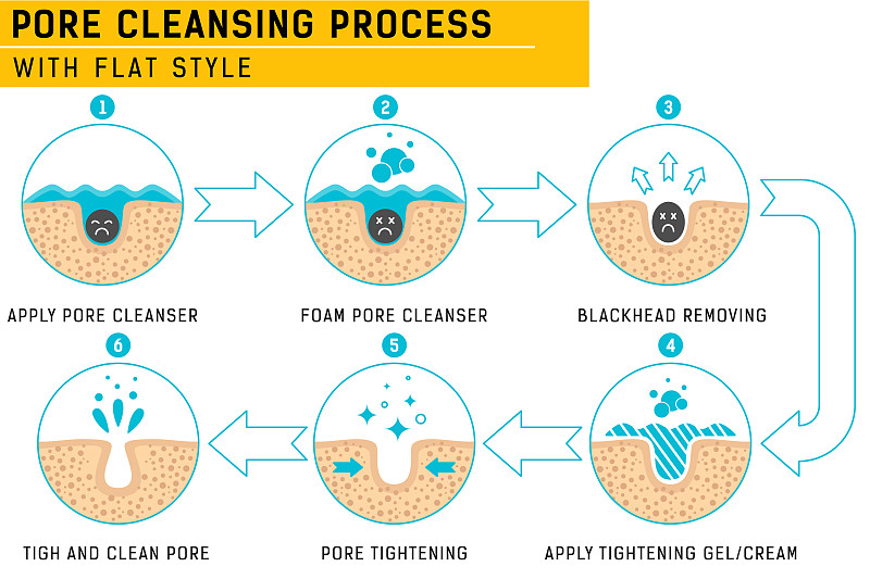 壳聚糖基生物材料促进皮肤伤口愈合：不足与创新改进