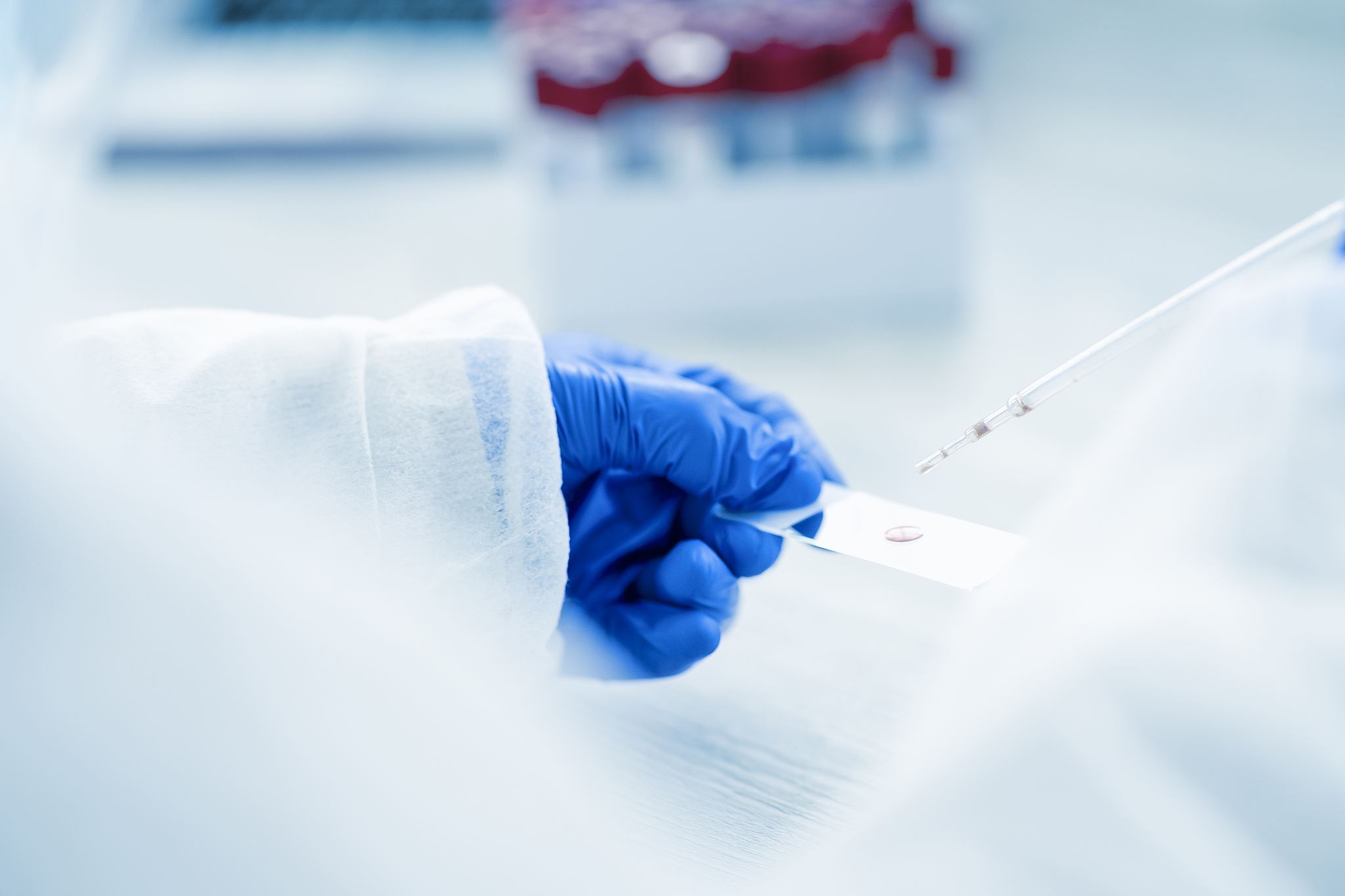 bloodtest