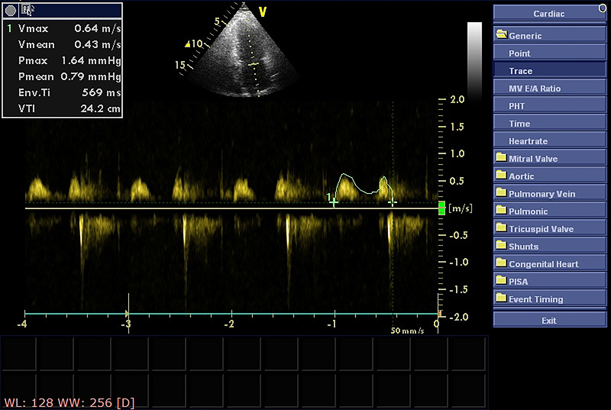 C++ 回调函数示例：使用 std::function 通知调用者
