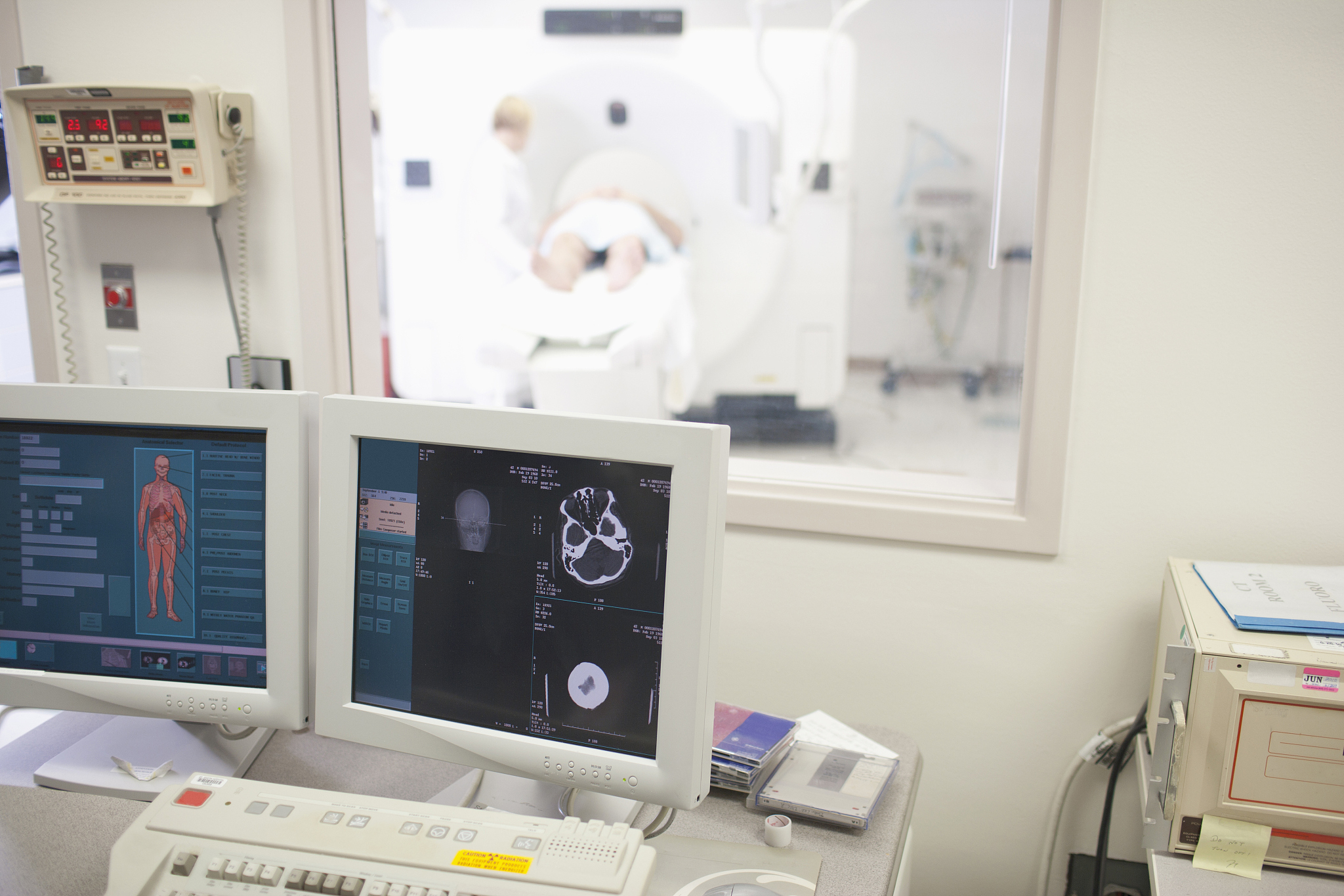 能做个监测大脑有没有被刺激的仪器吗？