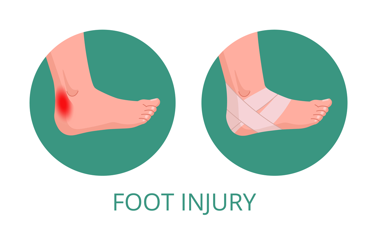 用疼痛的性质分类脚扭了的痛是什么痛