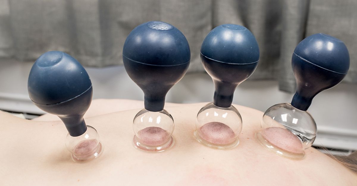 拔火罐吸盘的功效与作用