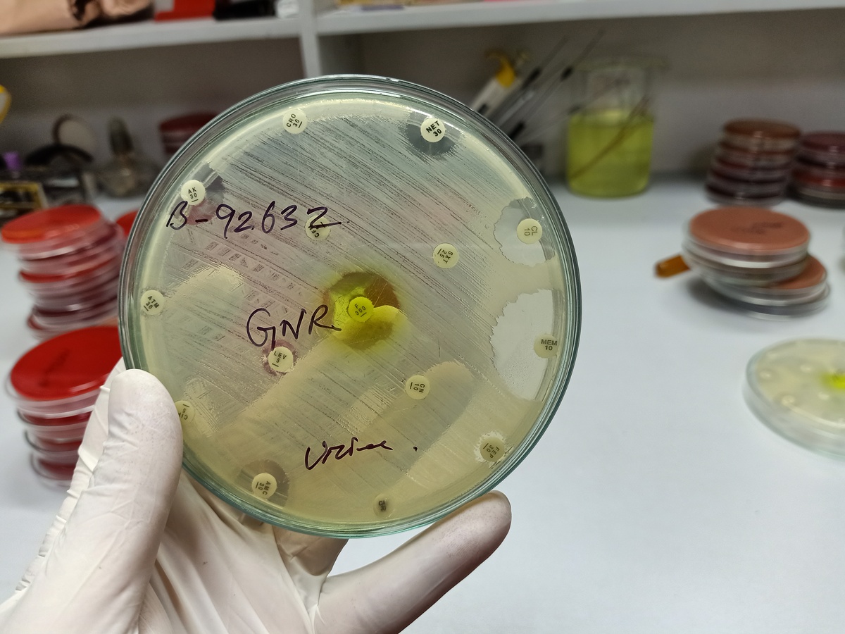 橡胶试片霉菌检测 - 浸渍试验方法详解