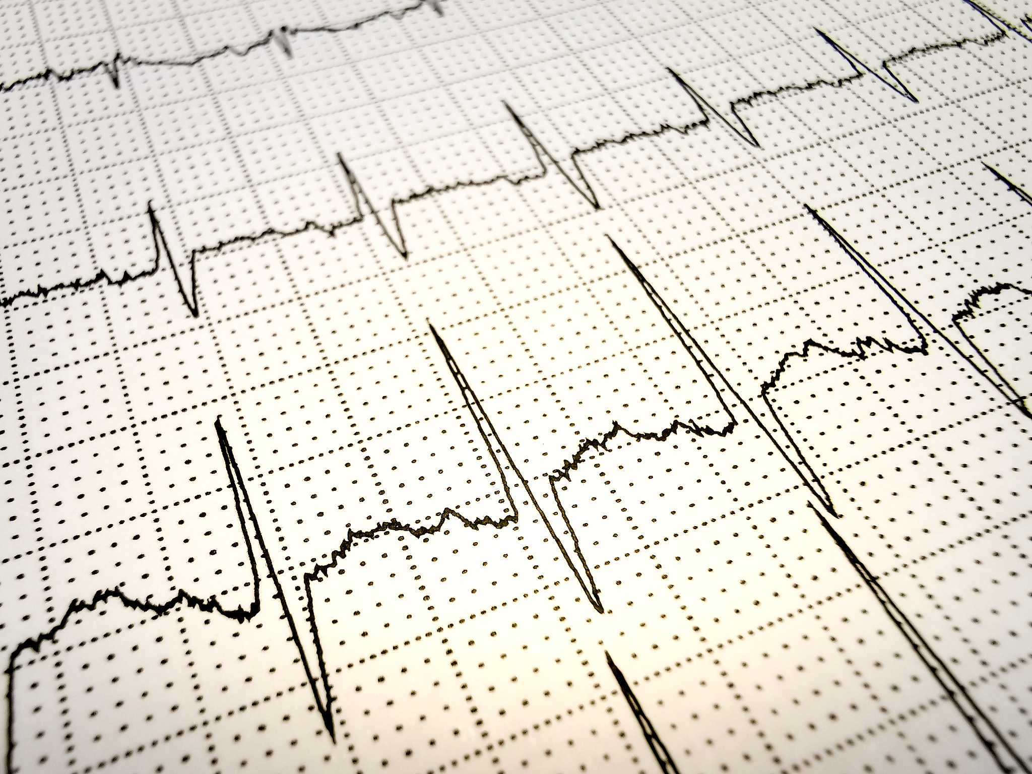 生理同步与A中的吸引力有关