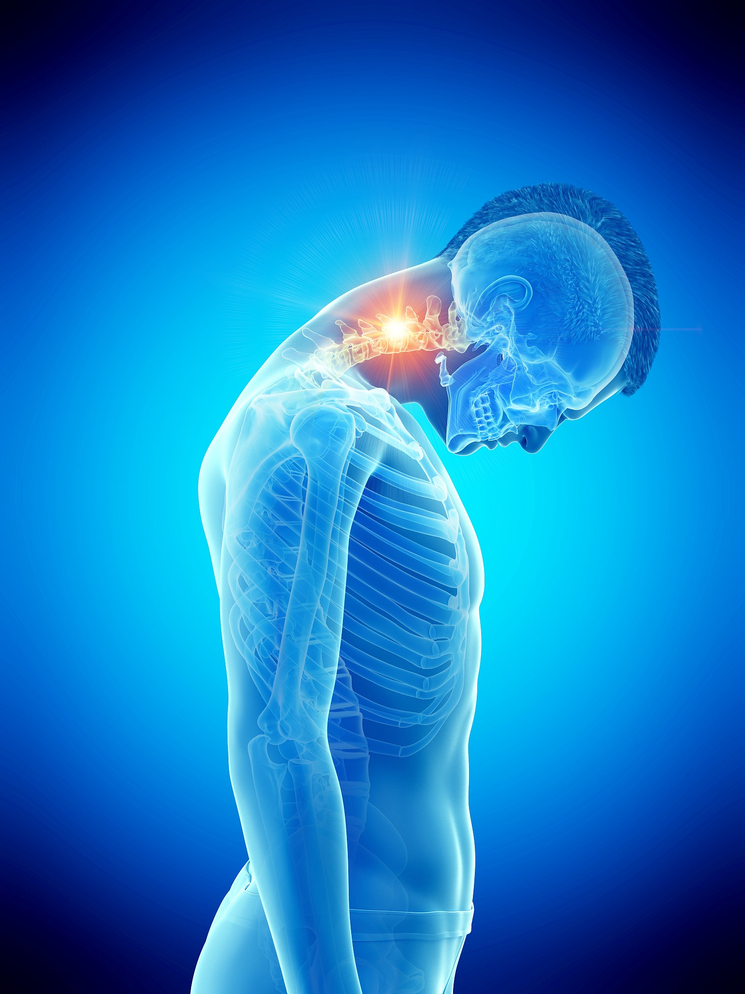 neck pain, conceptual illustration