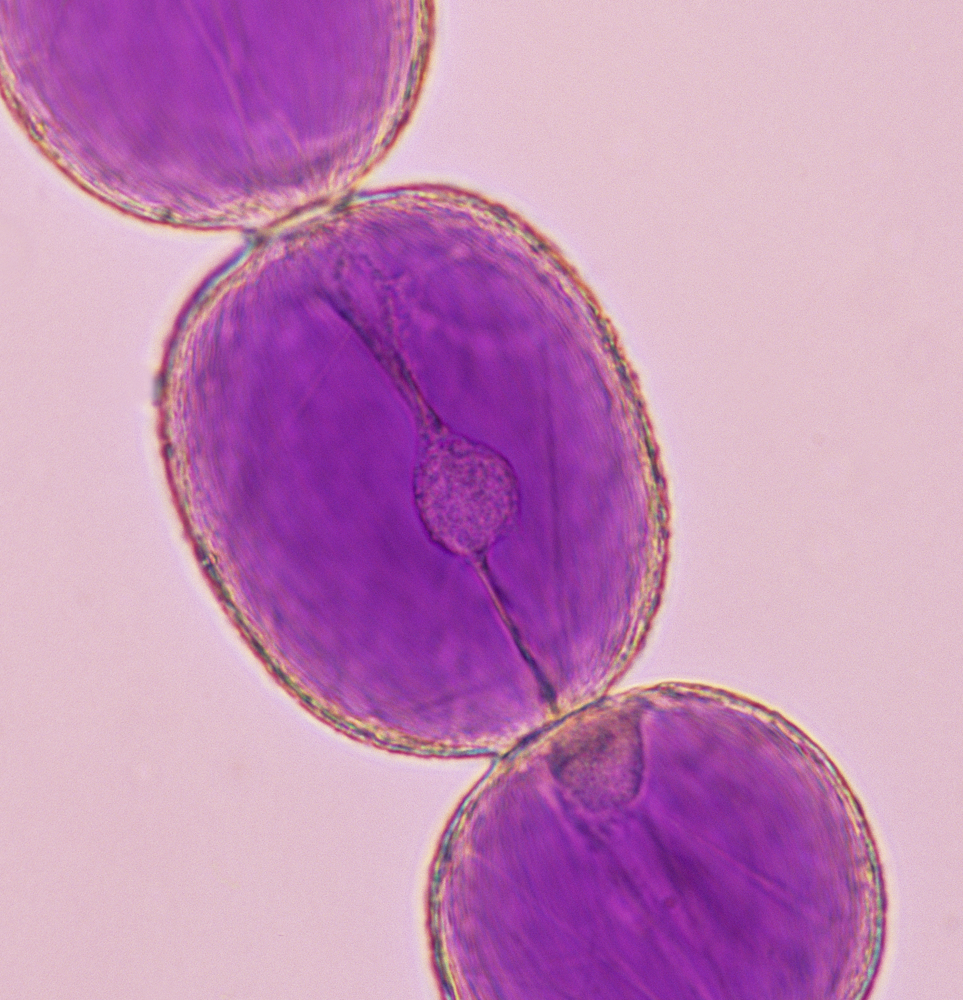 植物细胞的胞浆和胞质有什么区别