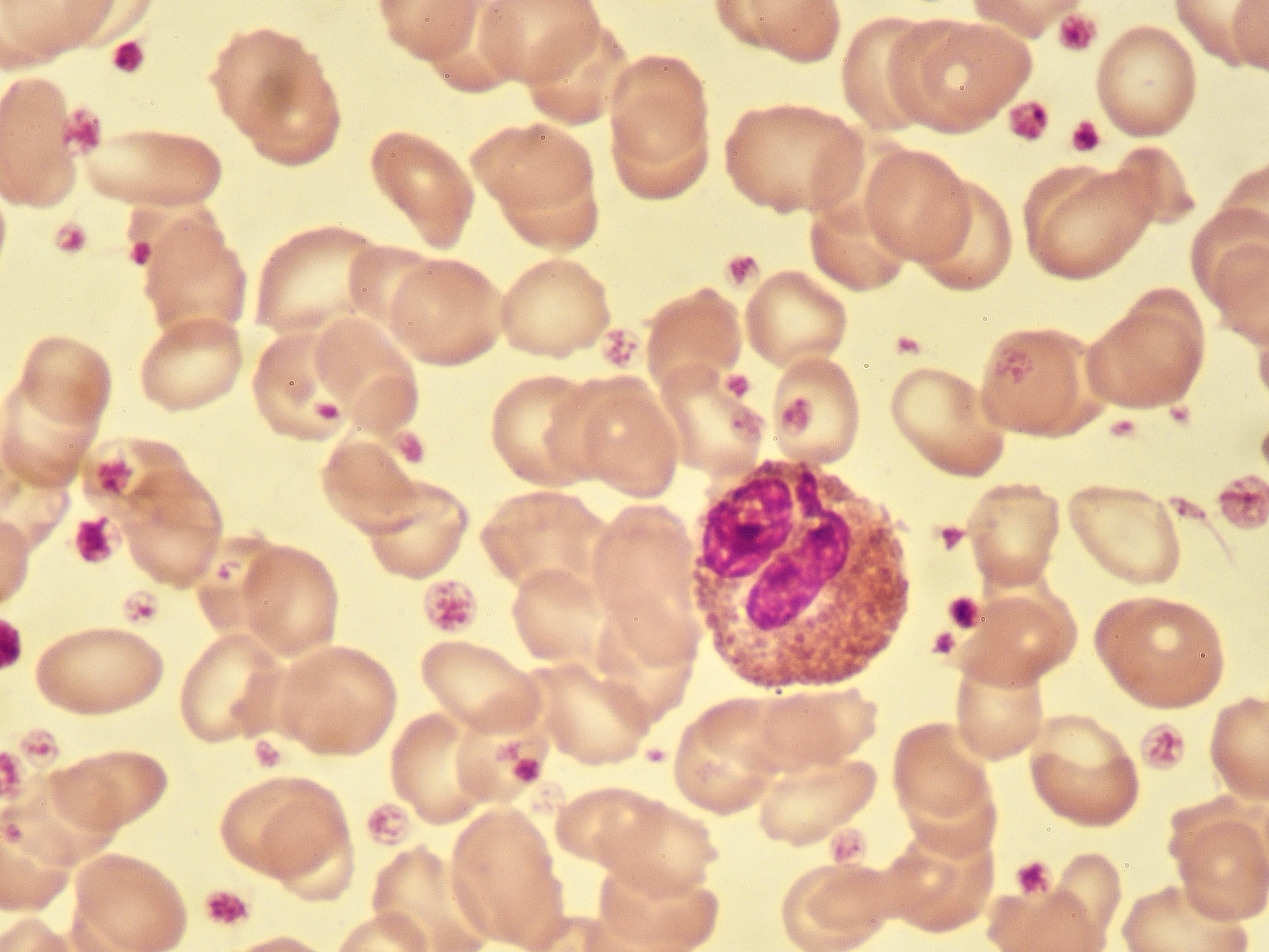 血凝反应(Hemagglutination)是什么？