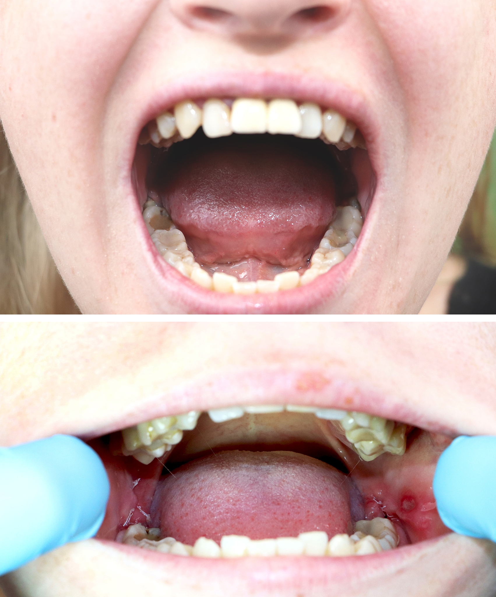 农村牙齿健康：影响因素及改善建议