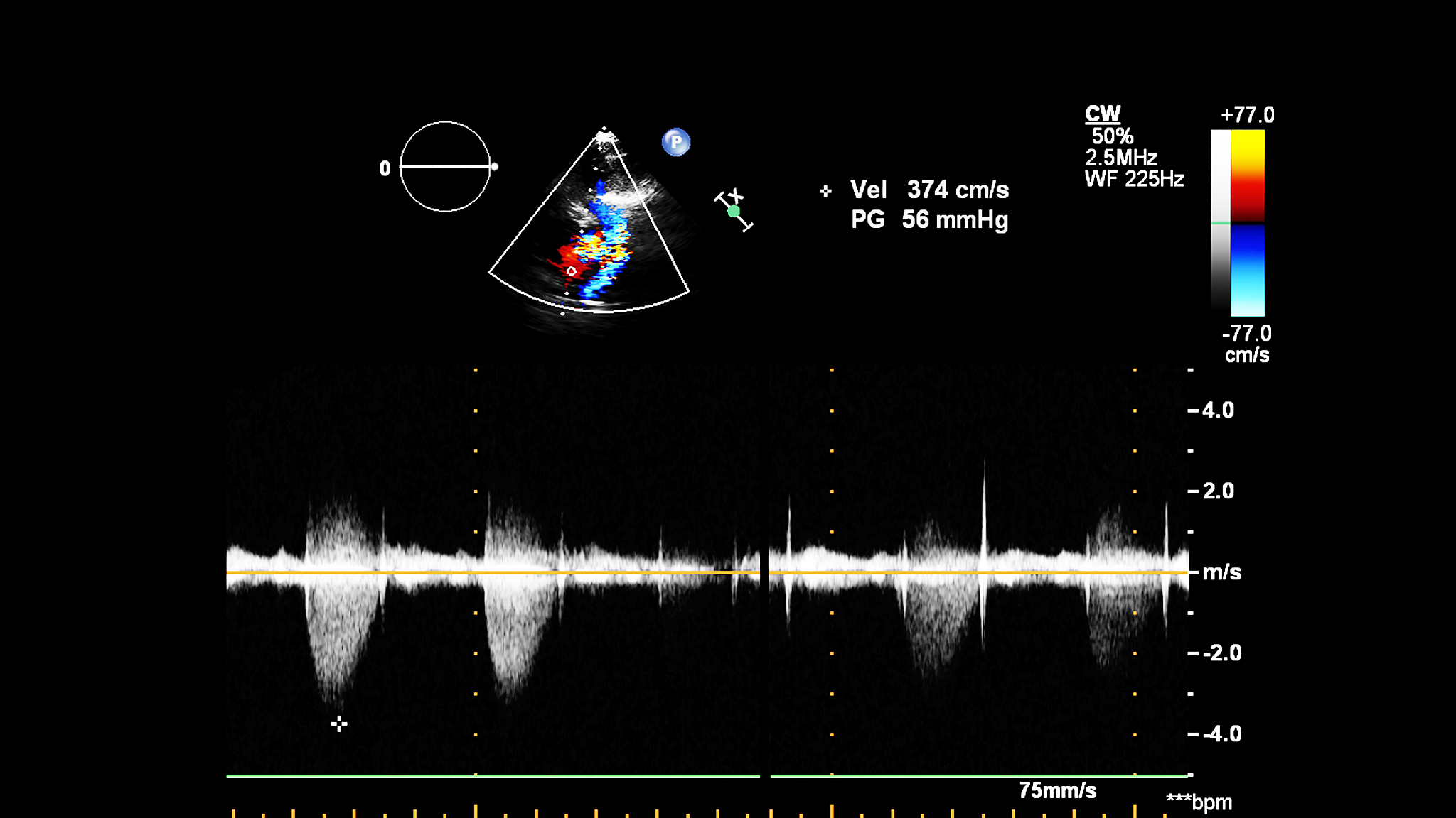 心电图时间常数与放大器的前置放大器高通滤波器频率响应RC耦合哪个有关。