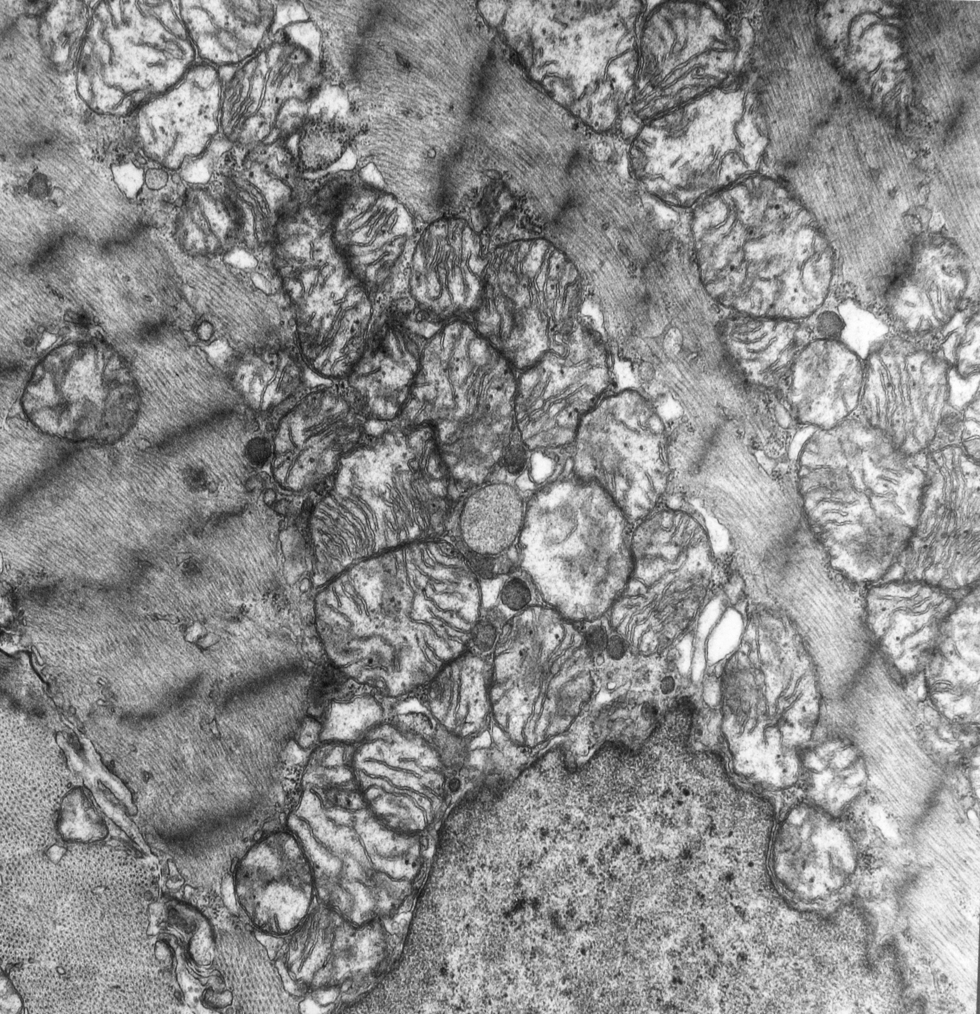 Co-Fe-ZrO2复合镀层显微硬度低于预期原因分析