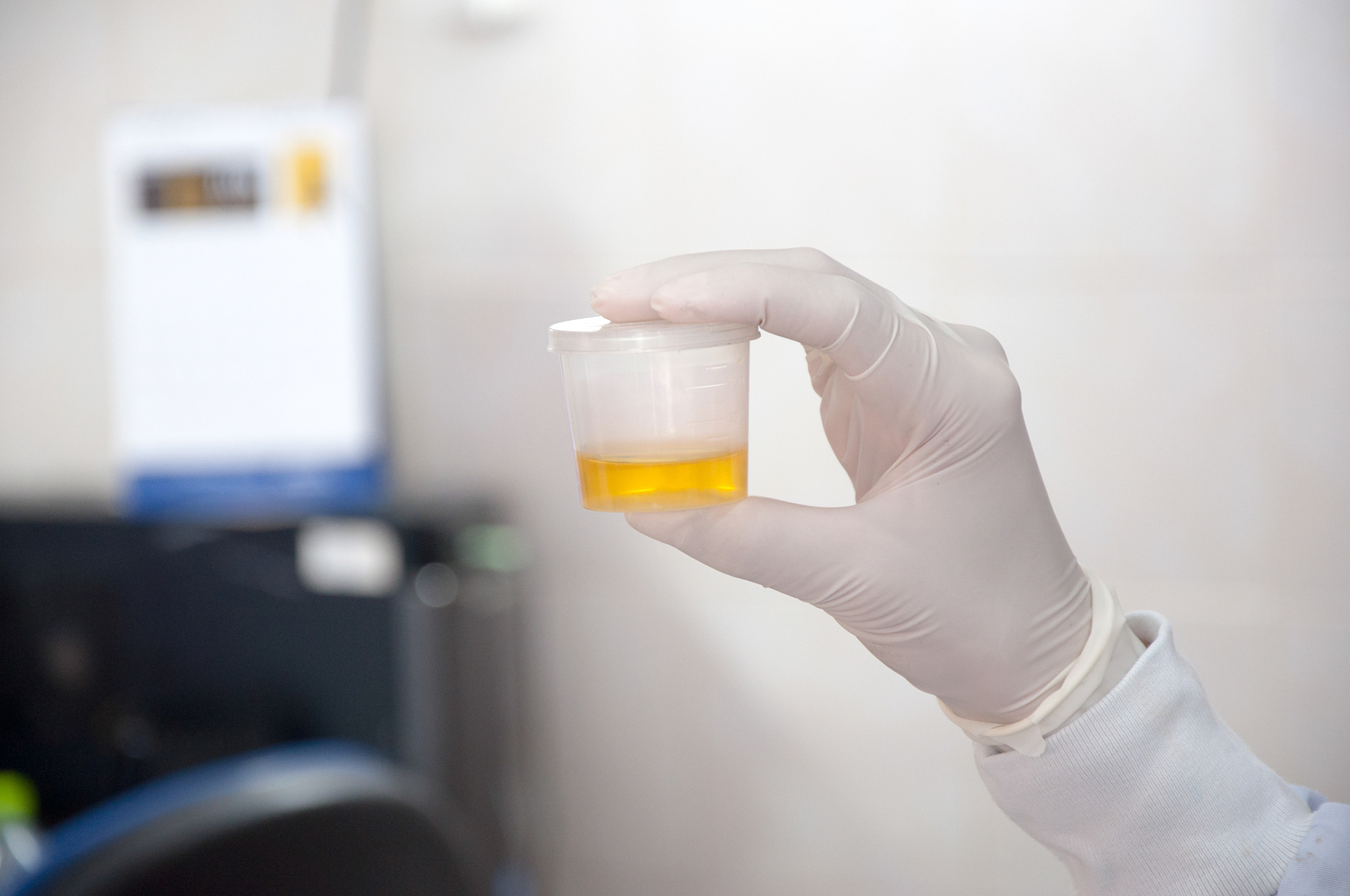 在肌糖原的酵解实验中某小组按照实验要求对照组和实验组样品进行逐一处理最后将样品放7沸腾的水浴中取出后发现实验组颜色并未变红且与对照组颜色无太大差别试分析实验失败原因