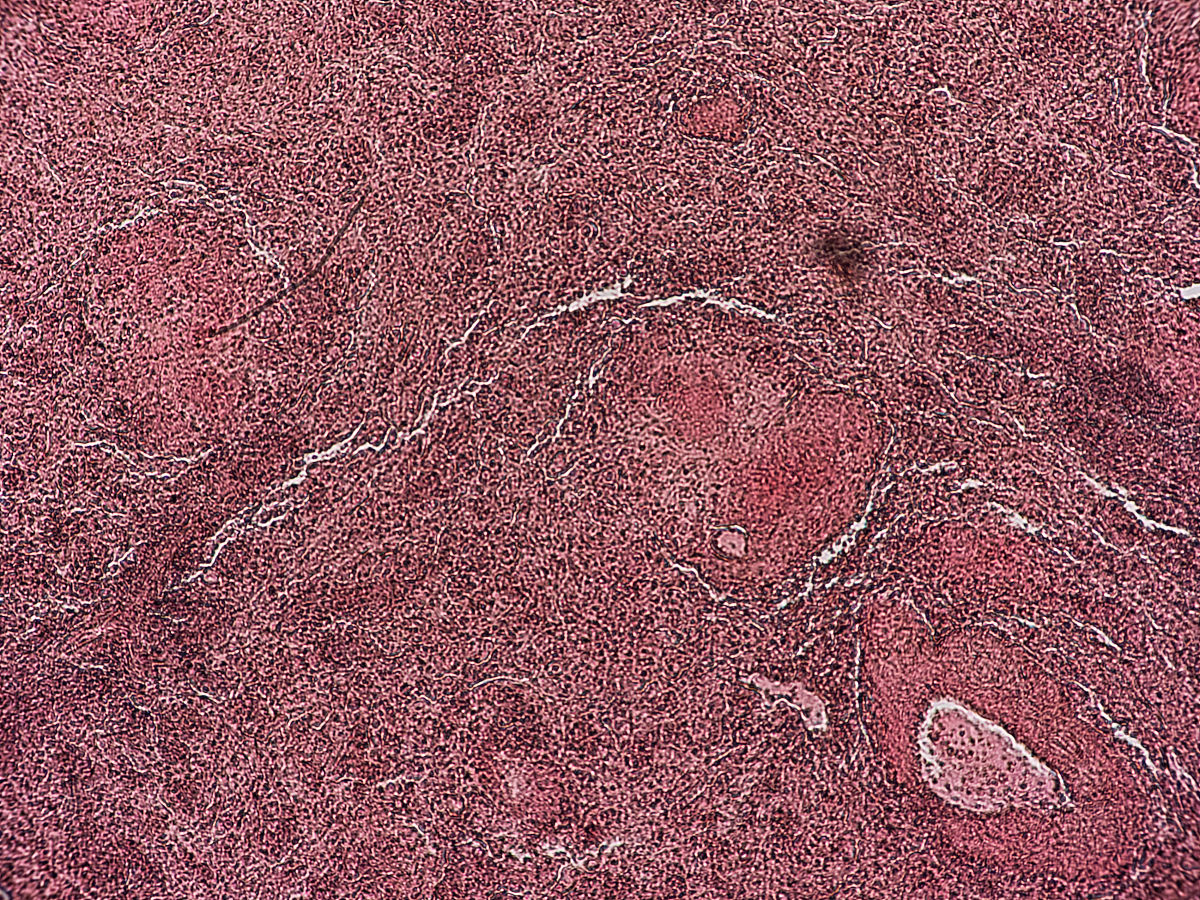 重庆医药高等专科学校医学检验专业就业前景怎么样