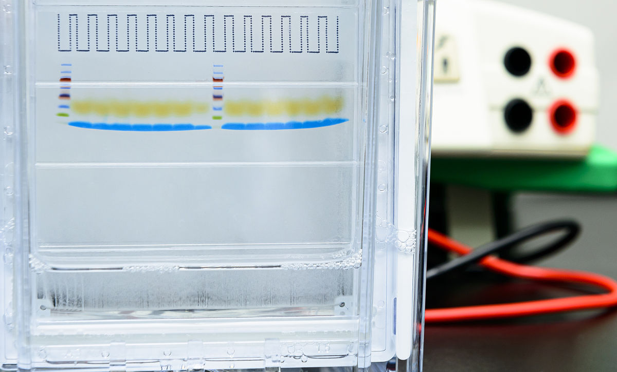 SDS-PAGE 考马斯亮蓝染色与脱色时间指南