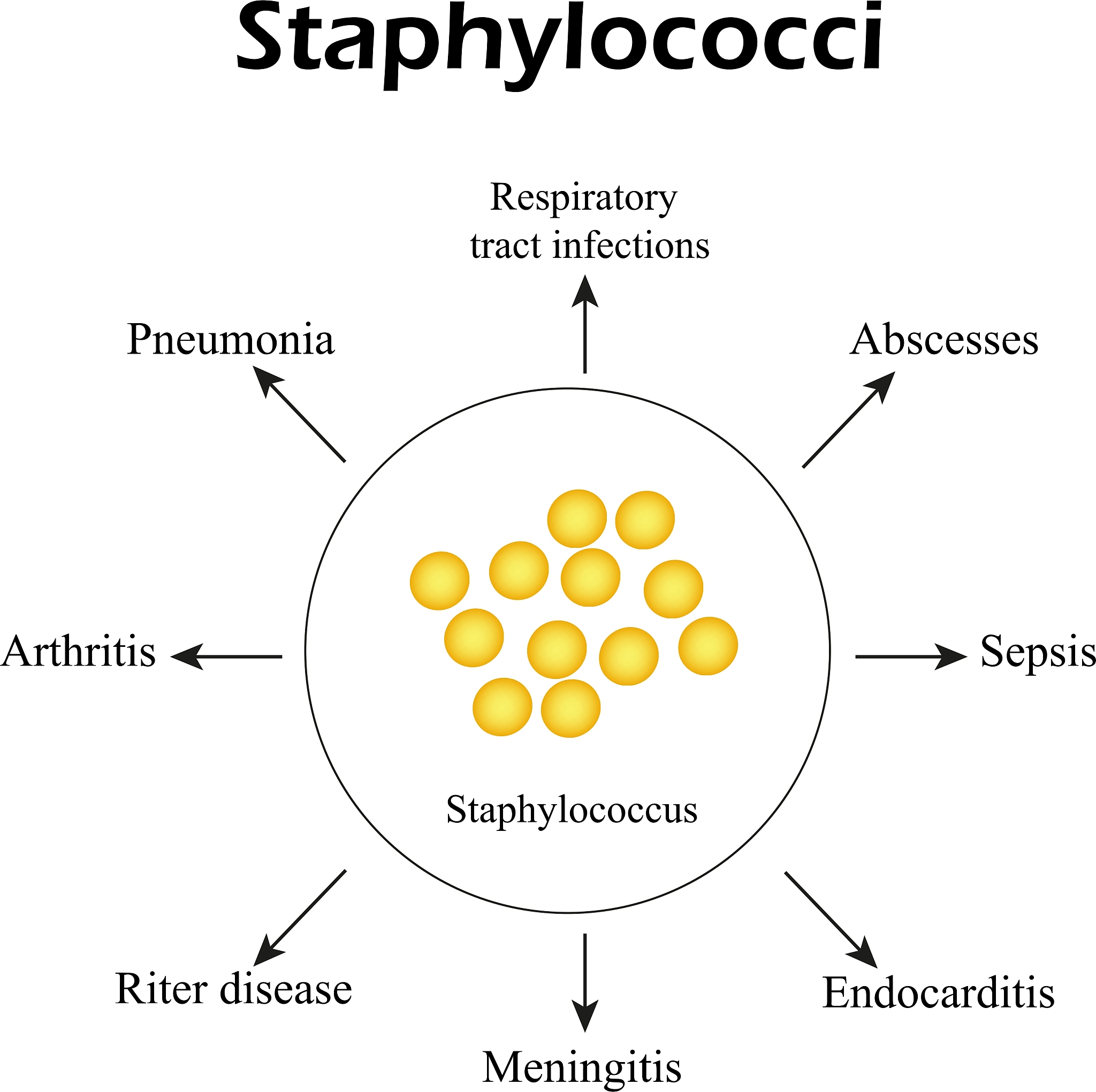 请帮我检查下文语法：Objective With the improvement of surgical procedures and perioperative management the postoperative mortality of patients with aortic coarctation has been reduced but the postoperative re-c