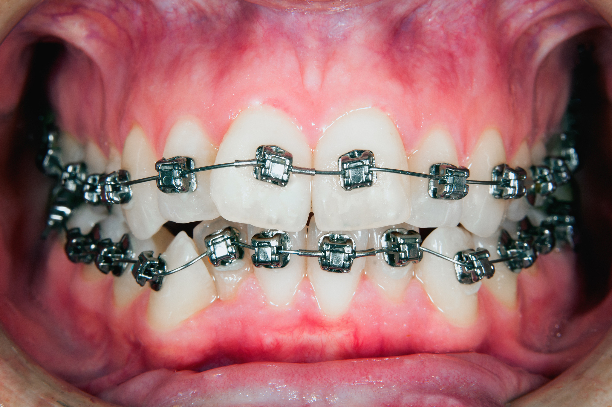 重庆卫生学校口腔修复专业：学什么？怎么样？