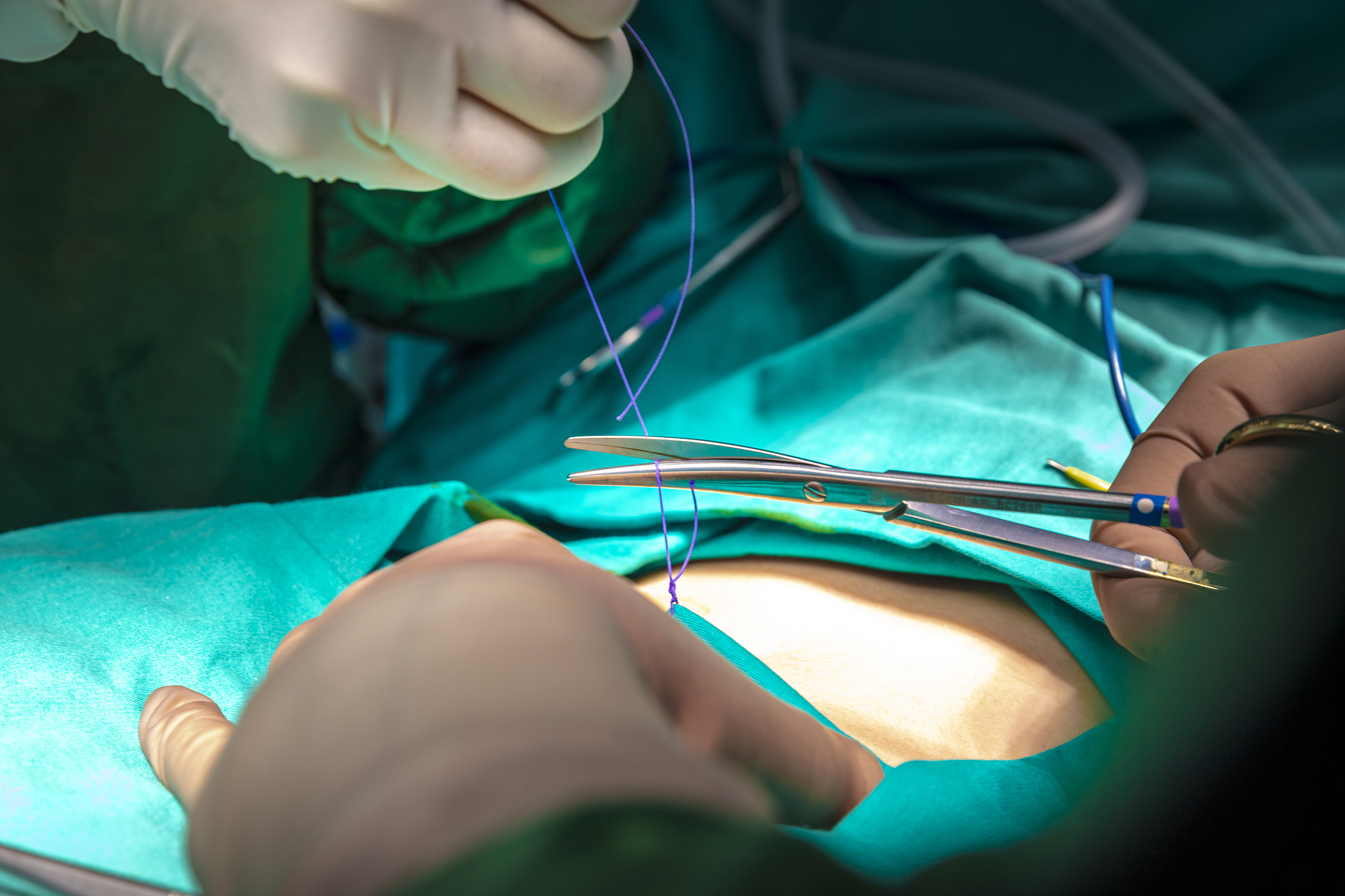 doctor make a surgical stitch