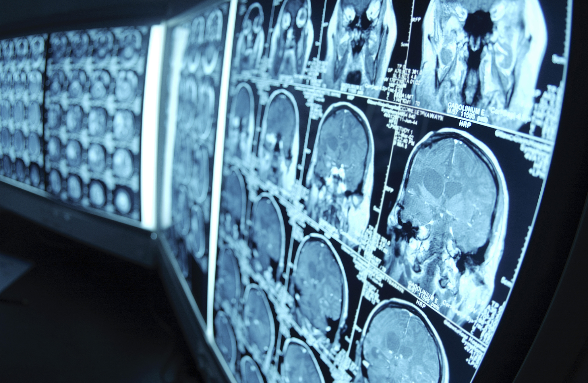 计算机视图像处理的项目设计背景