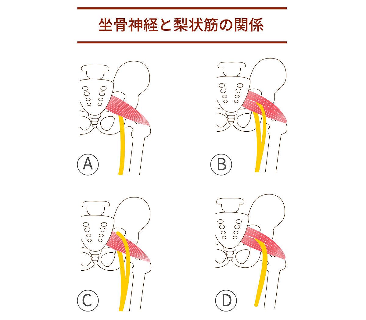 屁股左边疼怎么办