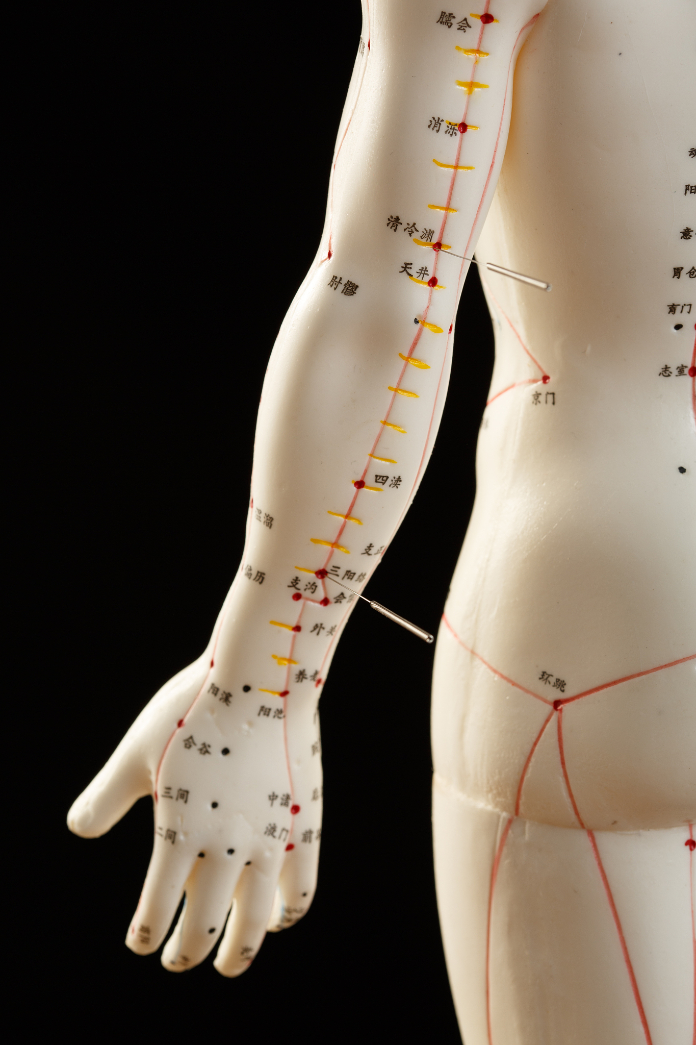 中风中经络针灸穴位歌诀：水沟、内关、三阴交等