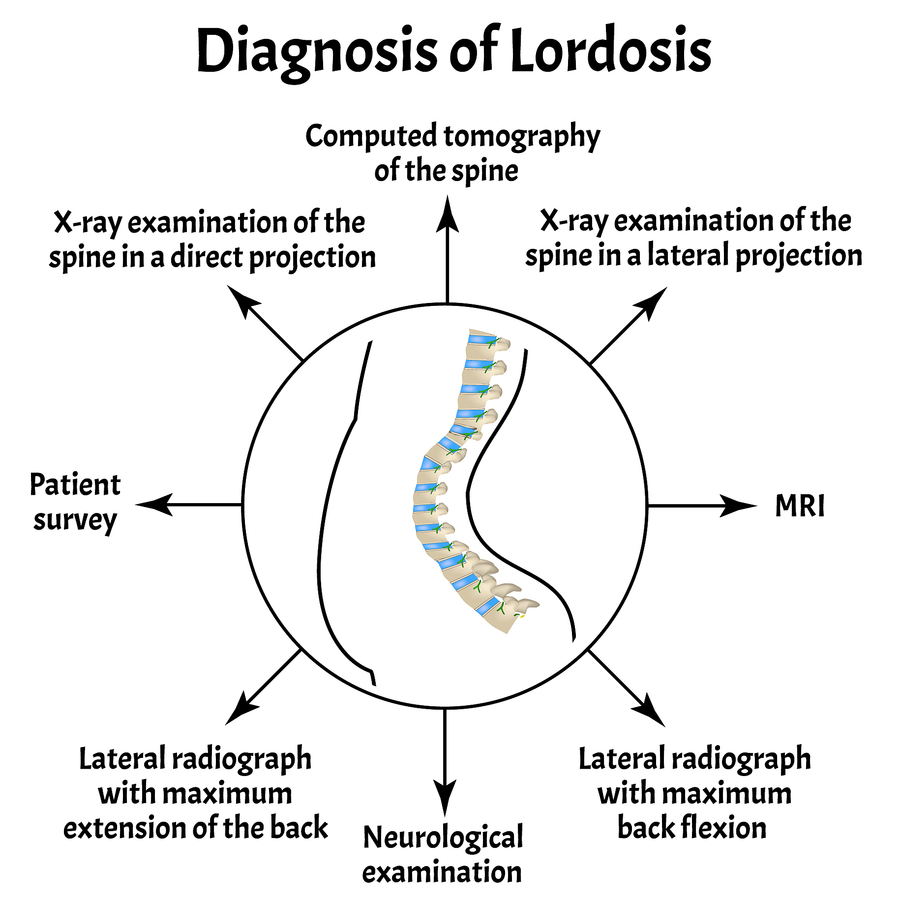 Atypical Caroli's Syndrome: A Case Report with Absent 'Central Sign'