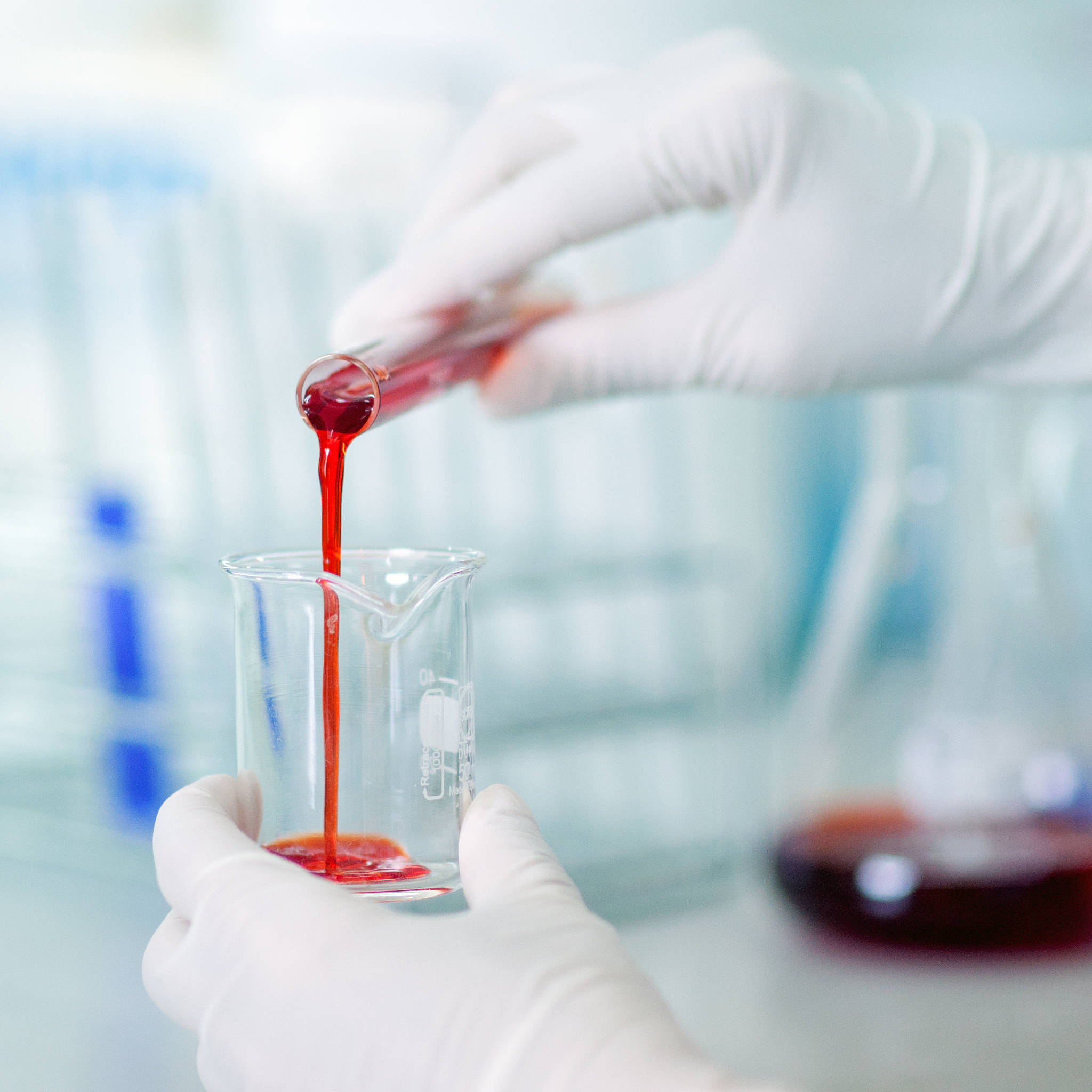 临床医学检验试题 - 血液学、尿液、肝功能等检验知识点解析