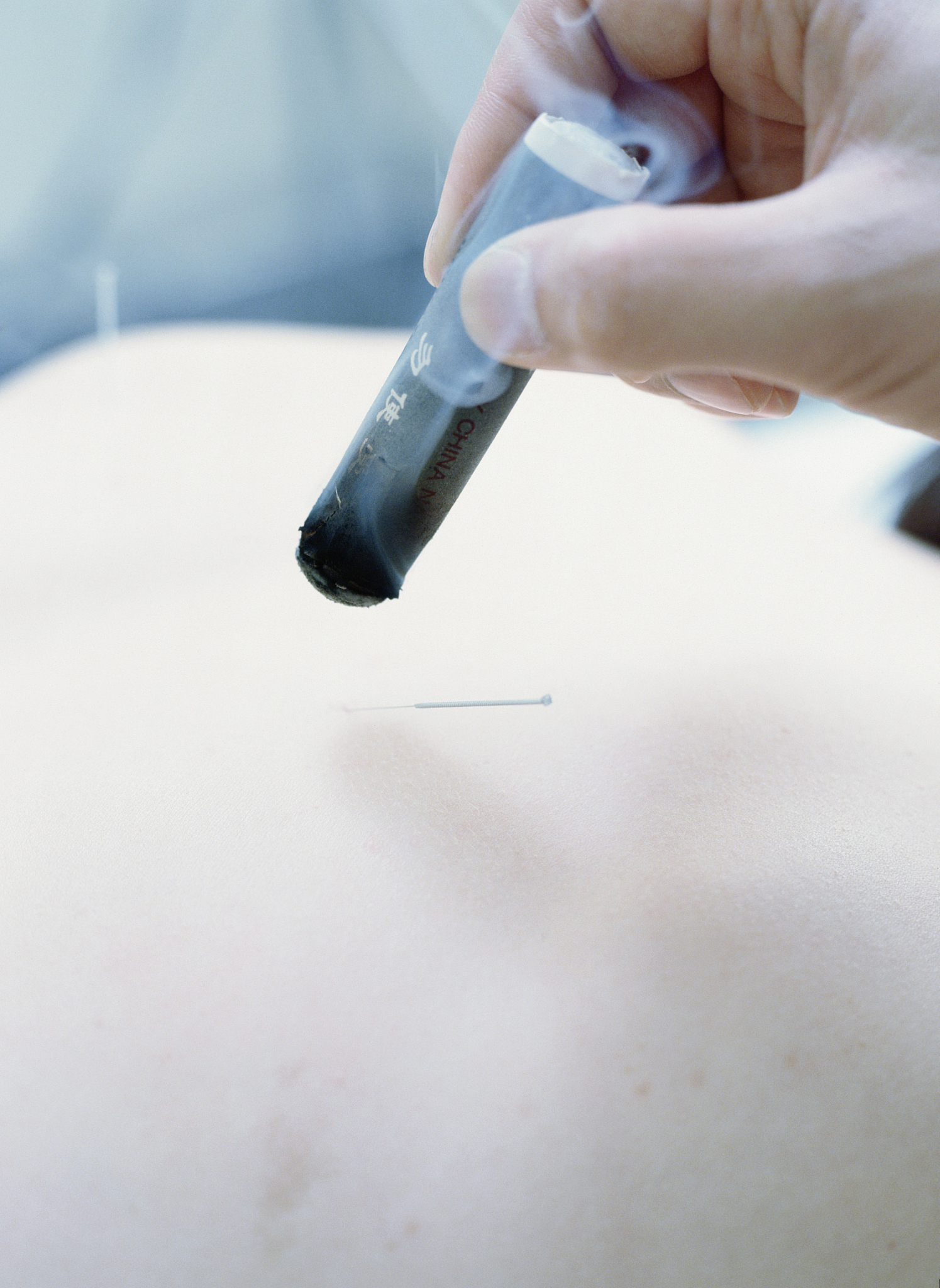 为一篇关于儿童睡眠障碍以中医药儿童睡眠障碍为关键词的文献综述选定一个标题和创建大纲