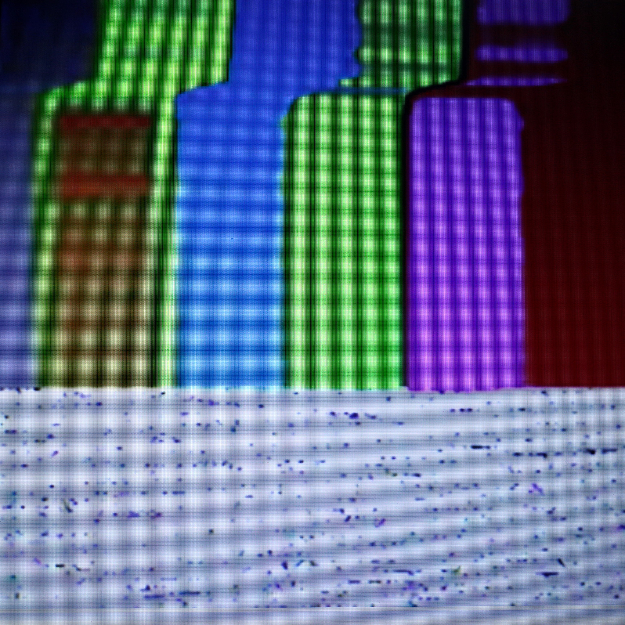 MATLAB 椒盐噪声图像处理：高斯低通滤波与中值滤波对比