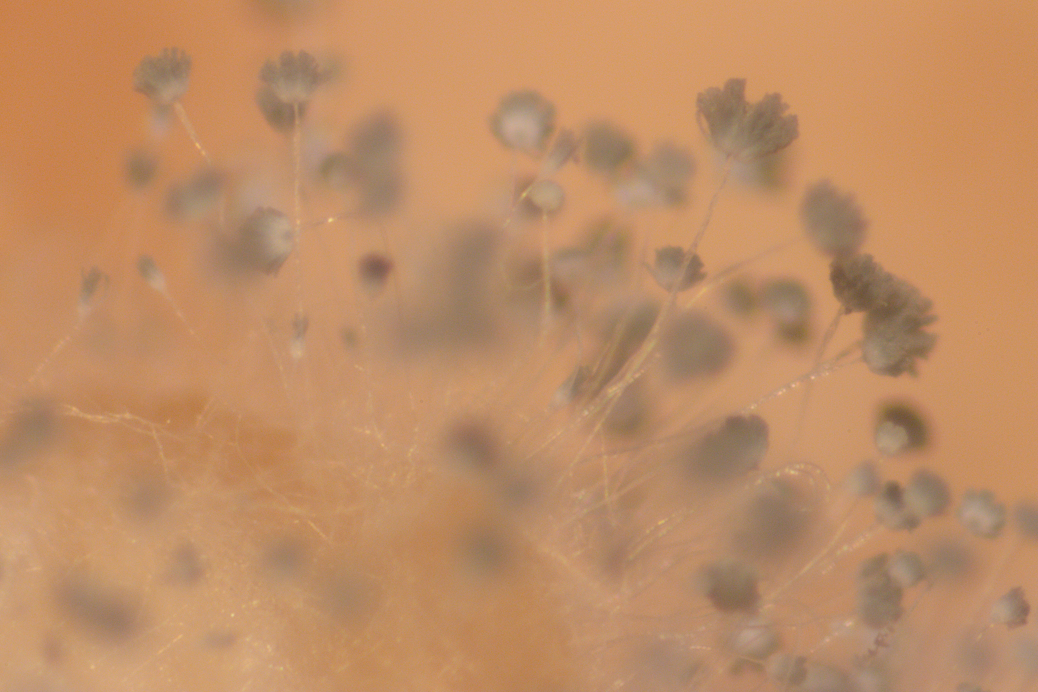 针对一下霉菌写一份观察他们显微镜结过后得出共同结论 1、青霉 2、曲霉 3、黑根霉 4、匍枝根霉5、面包霉 6、有隔菌丝 7、无隔菌丝