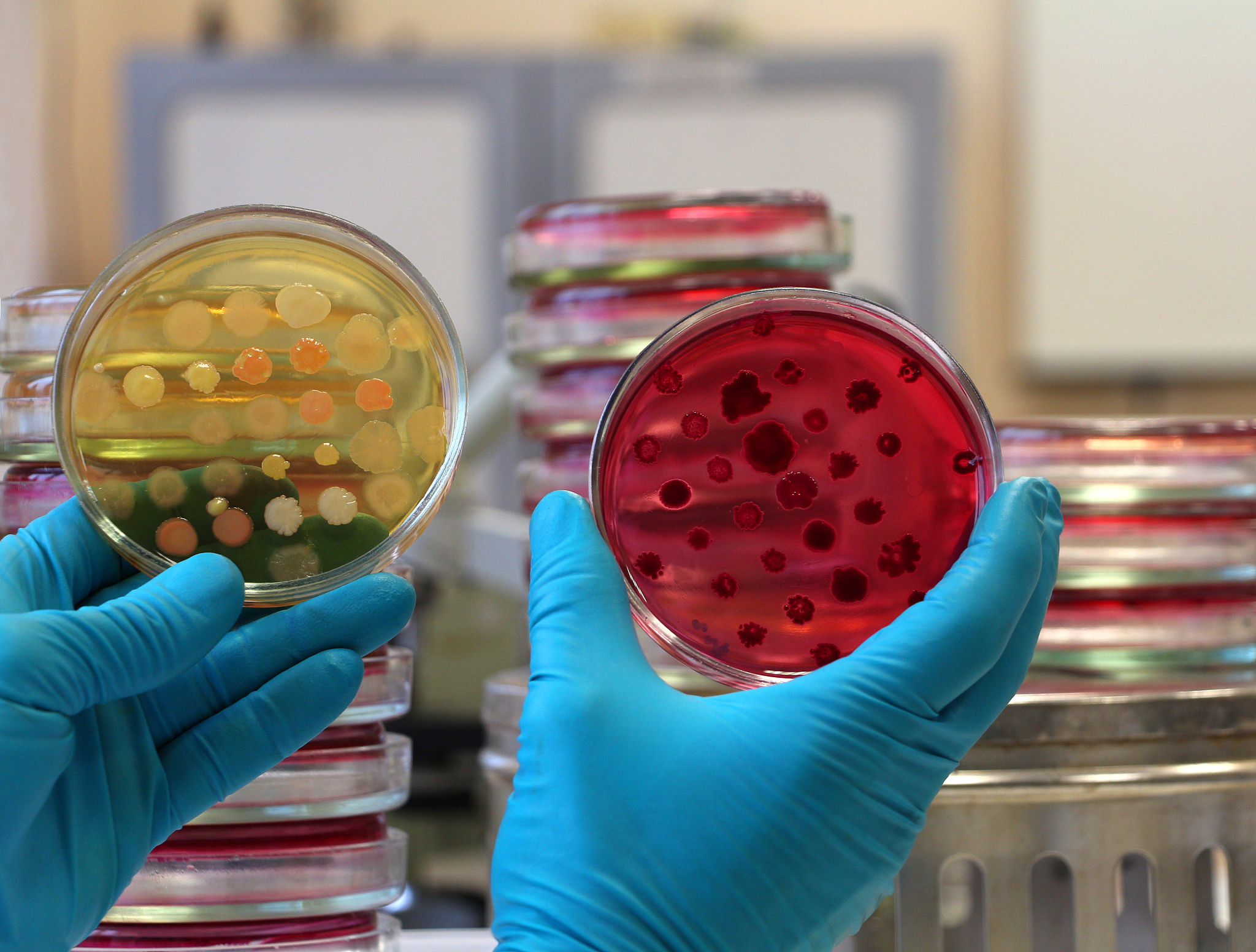 琼脂培养基一般的比例是多少