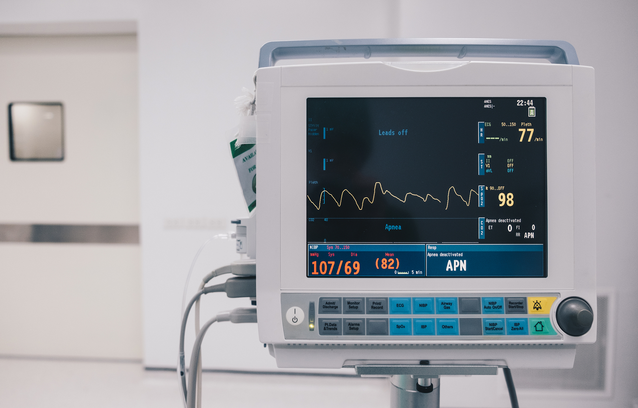 基于心脏检测雷达的病房检测系统