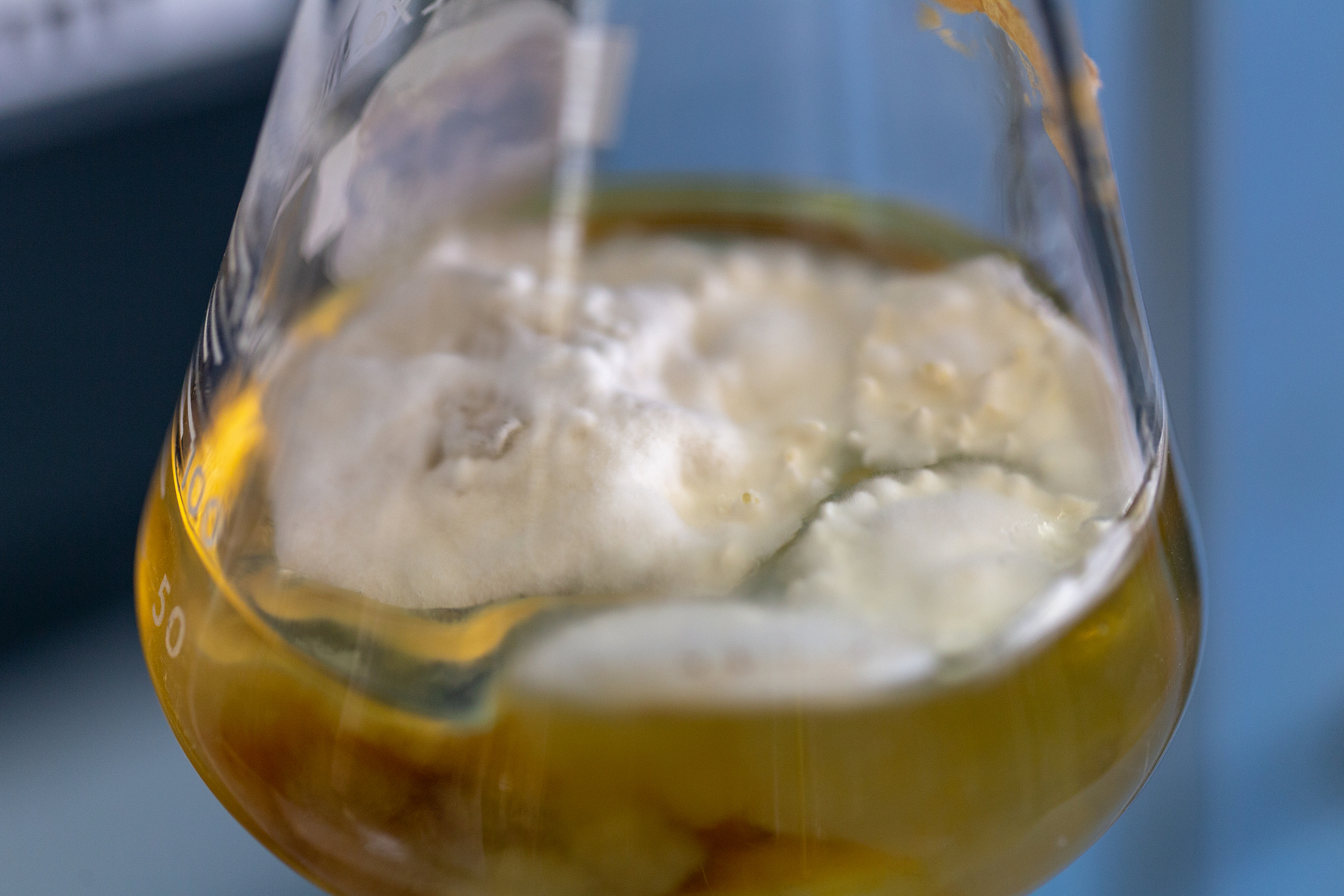 射精后尿液有泡沫？别担心，可能是这个原因！