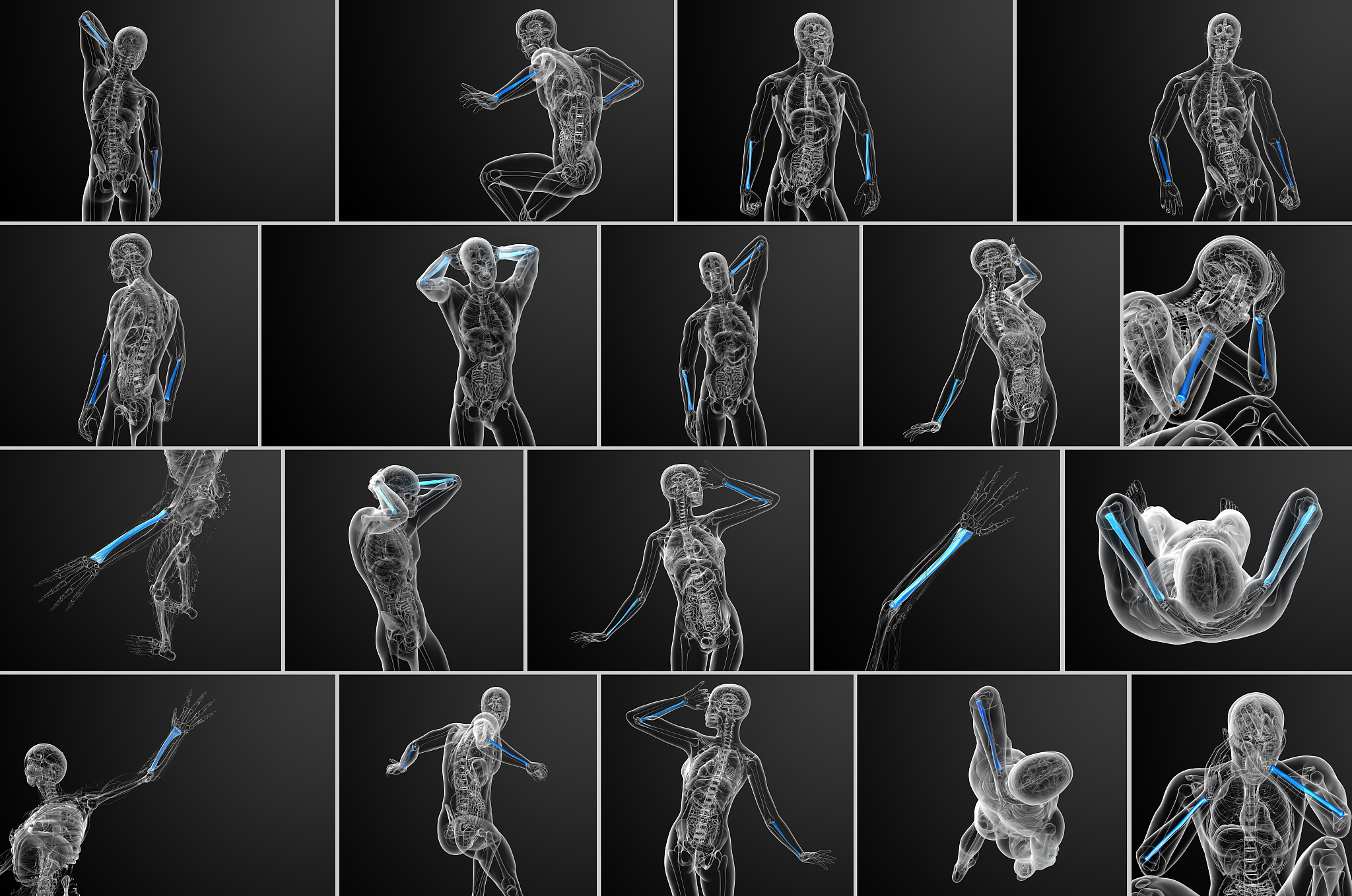 unity2d中如何给人物创建骨骼