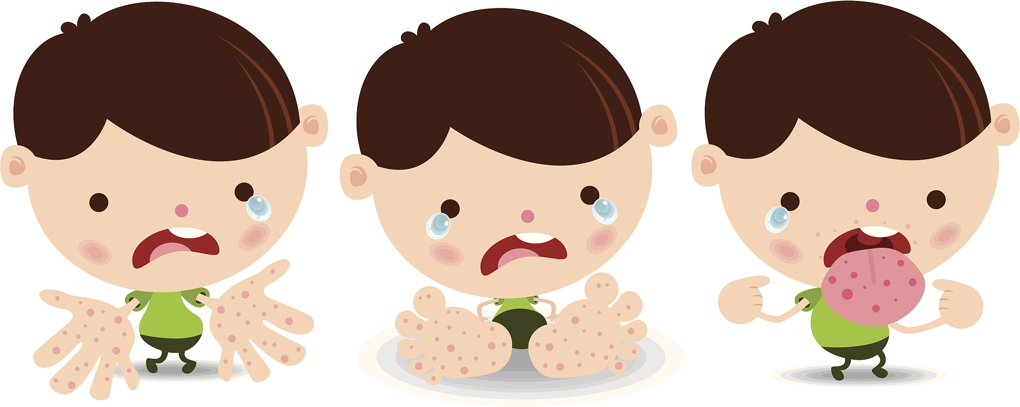 儿童手足口病咳嗽吗